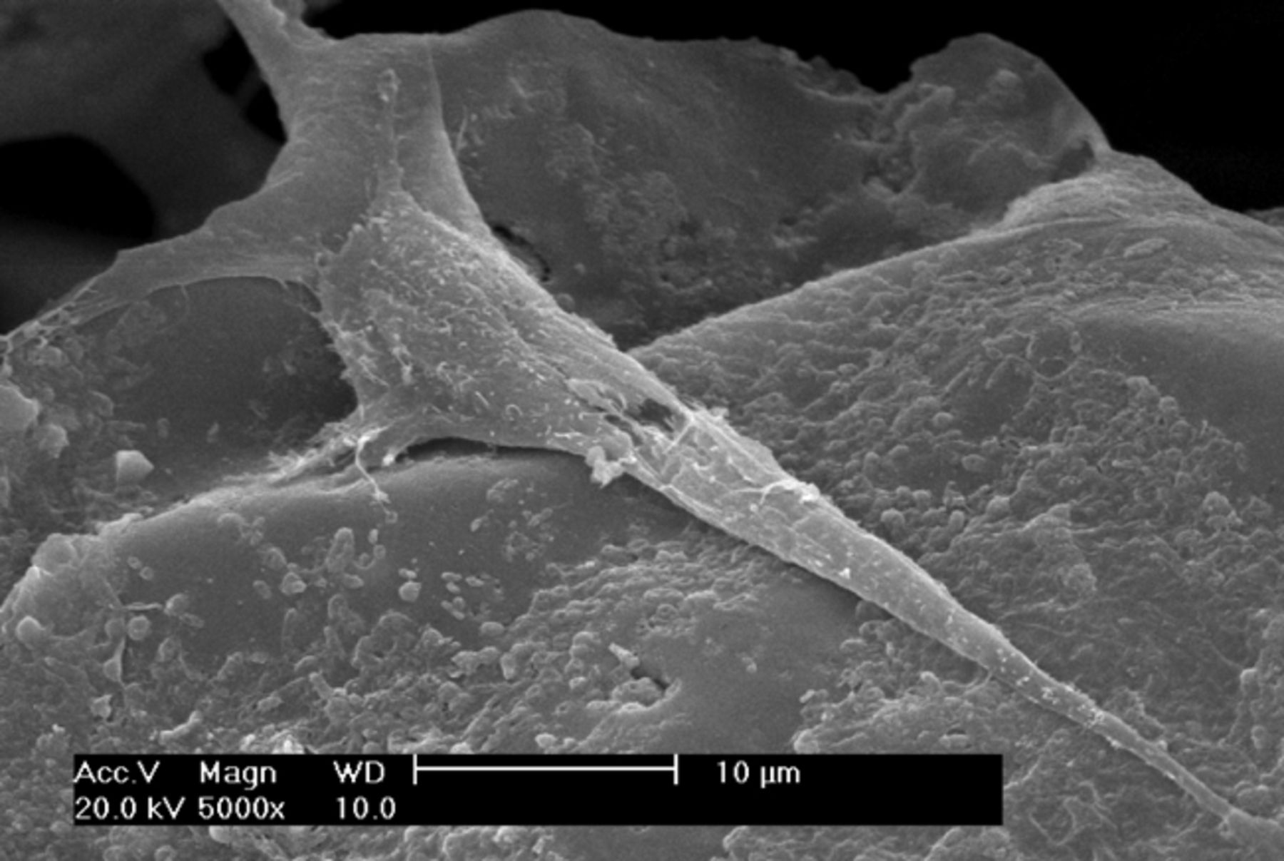 Figs. 2a - 2f 
          Scanning electron microscope
micrographs of bone marrow stromal cells cultured on the scaffold
showing a) the upper layer of the scaffold after one day in culture,
b) lower layer of the scaffold after one day in culture, c) upper
layer of the scaffold after three days of culture, d) lower layer
of the scaffold after three days of culture, e) upper layer of the
scaffold after seven days of culture and f) lower layer of the scaffold
after seven days of culture.
        