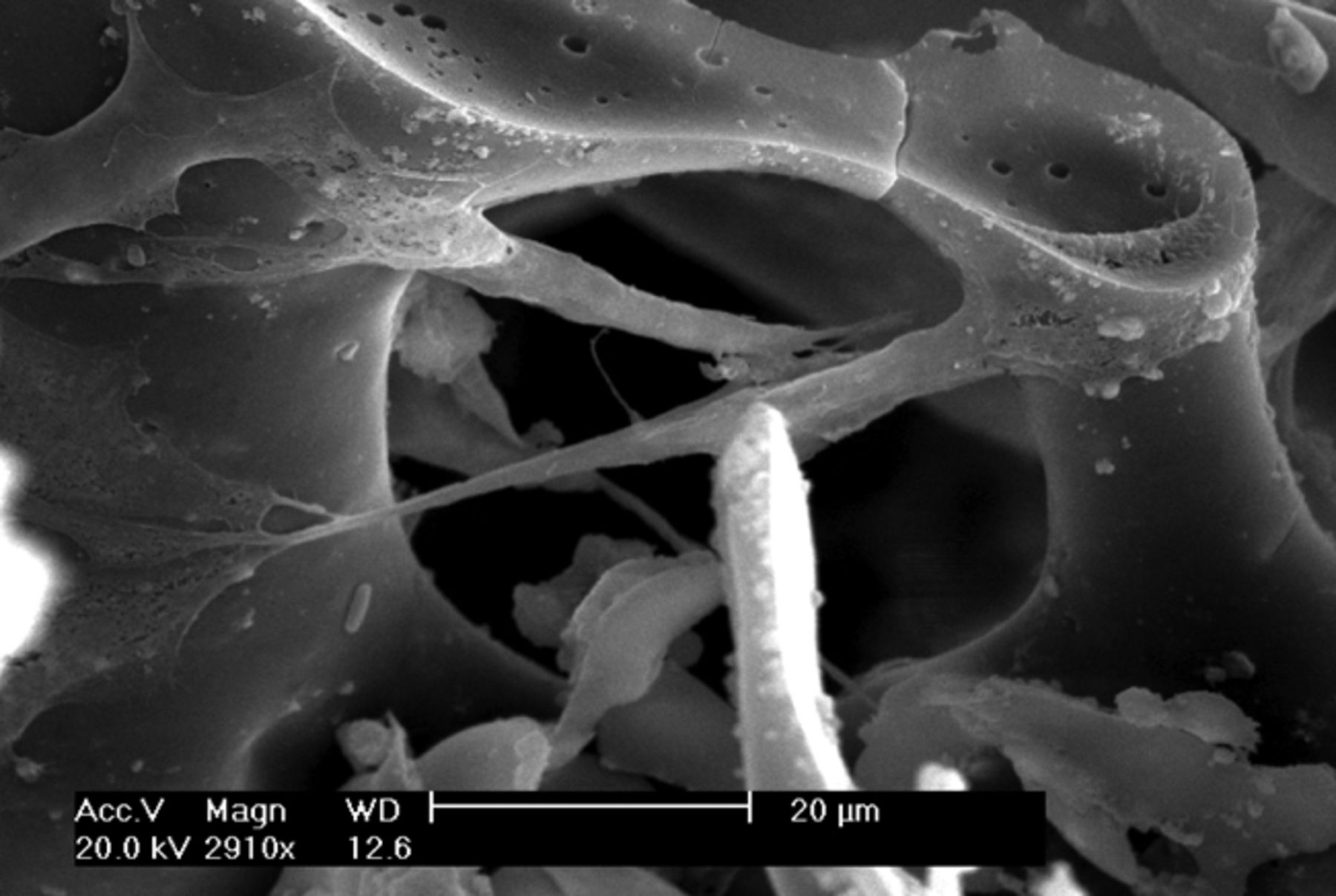 Figs. 2a - 2f 
          Scanning electron microscope
micrographs of bone marrow stromal cells cultured on the scaffold
showing a) the upper layer of the scaffold after one day in culture,
b) lower layer of the scaffold after one day in culture, c) upper
layer of the scaffold after three days of culture, d) lower layer
of the scaffold after three days of culture, e) upper layer of the
scaffold after seven days of culture and f) lower layer of the scaffold
after seven days of culture.
        