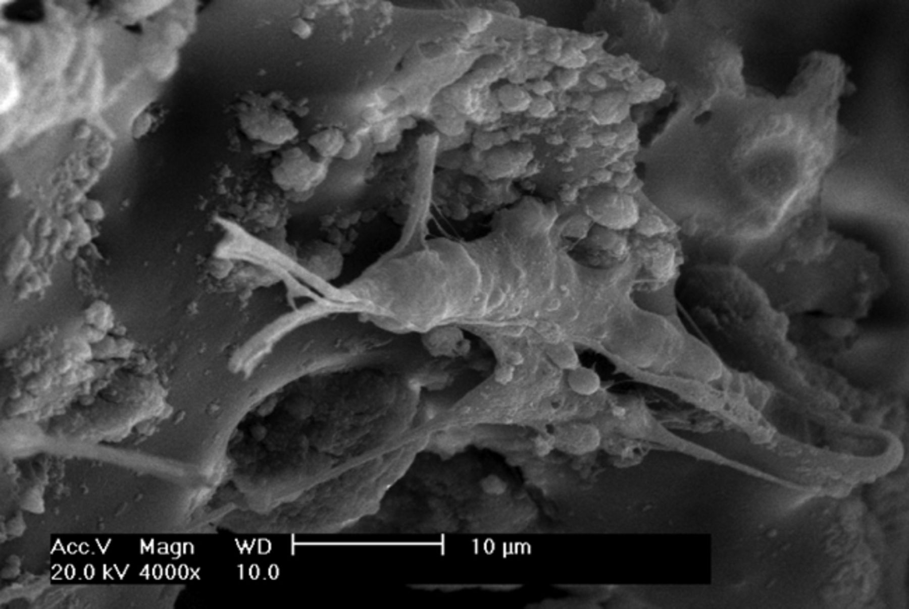 Figs. 2a - 2f 
          Scanning electron microscope
micrographs of bone marrow stromal cells cultured on the scaffold
showing a) the upper layer of the scaffold after one day in culture,
b) lower layer of the scaffold after one day in culture, c) upper
layer of the scaffold after three days of culture, d) lower layer
of the scaffold after three days of culture, e) upper layer of the
scaffold after seven days of culture and f) lower layer of the scaffold
after seven days of culture.
        