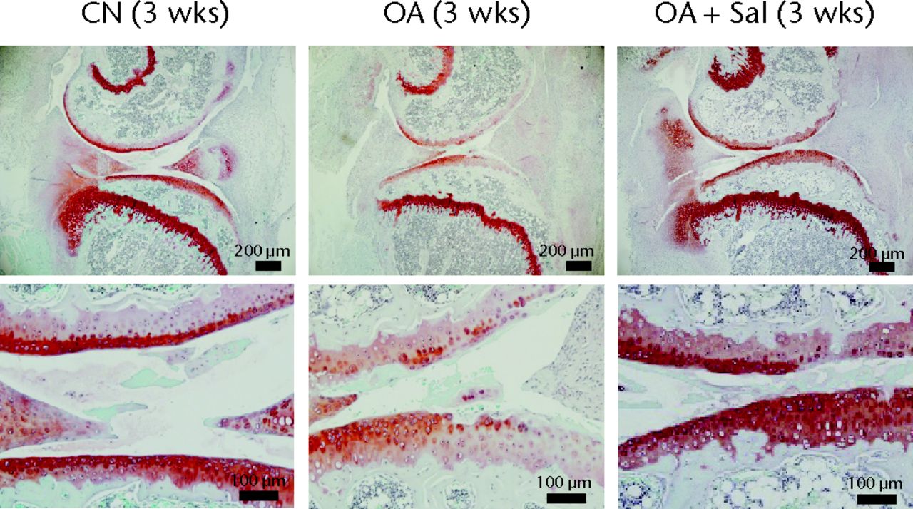 Figs. 2a - 2b 
            Images of safranin O staining of
the sagittal knee joint section, with a) samples three weeks after
induction of osteoarthritis (OA, placebo sample; OA + Sal, Salubrinal-treated
OA sample; CN, sham control sample) and b) samples six weeks after
induction of OA shown. The three panels in the top row show an entire
knee section (bar = 200 µm), while the three panels in the bottom row
depict their enlarged images (bar = 100 µm). The top section in
each panel is the femur, and the bottom section is the tibia.
          