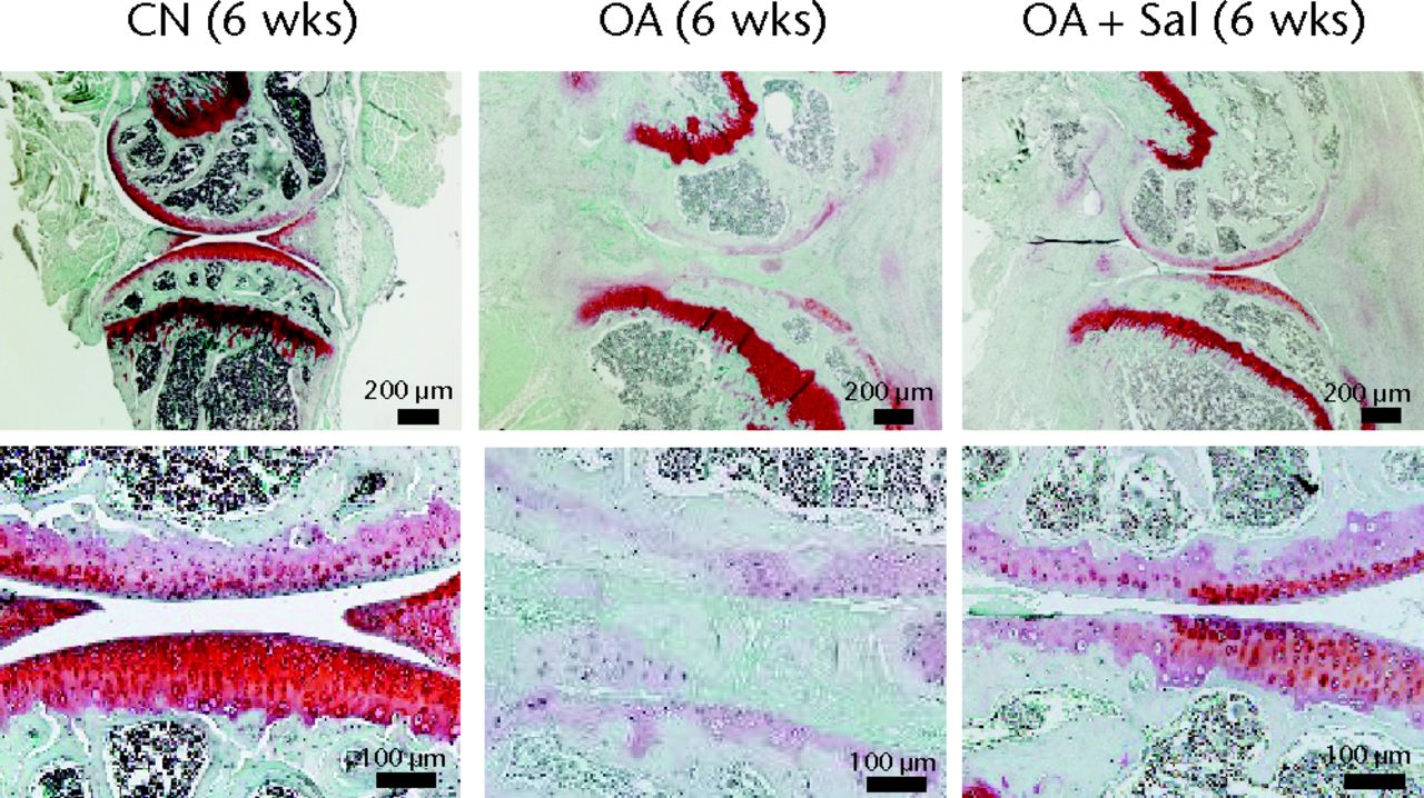 Figs. 2a - 2b 
            Images of safranin O staining of
the sagittal knee joint section, with a) samples three weeks after
induction of osteoarthritis (OA, placebo sample; OA + Sal, Salubrinal-treated
OA sample; CN, sham control sample) and b) samples six weeks after
induction of OA shown. The three panels in the top row show an entire
knee section (bar = 200 µm), while the three panels in the bottom row
depict their enlarged images (bar = 100 µm). The top section in
each panel is the femur, and the bottom section is the tibia.
          