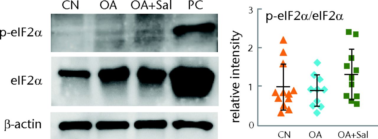 Figs. 6a - 6b 
            Graphs and staining showing evaluation
of the phosphorylation level of eukaryotic translation initiation
factor 2 alpha (eIF2α) in cartilage samples and C28/I2 chondrocytes,
with a) levels of p-eIF2α in tibial cartilage samples (three weeks
after the induction of osteoarthritis; OA); (n = 12 CN, sham control,
10 OA placebo, and 11 OA + Salubrinal (Sal)) and b) levels of p-eIF2α in
C28/I2 chondrocytes treated with TNFα in the presence and absence of
5 µM Salubrinal for 15, 30, and 360 minutes shown. Thapsigargin
at 1 µM was used as a positive control (PC) for p-eIF2α.
          