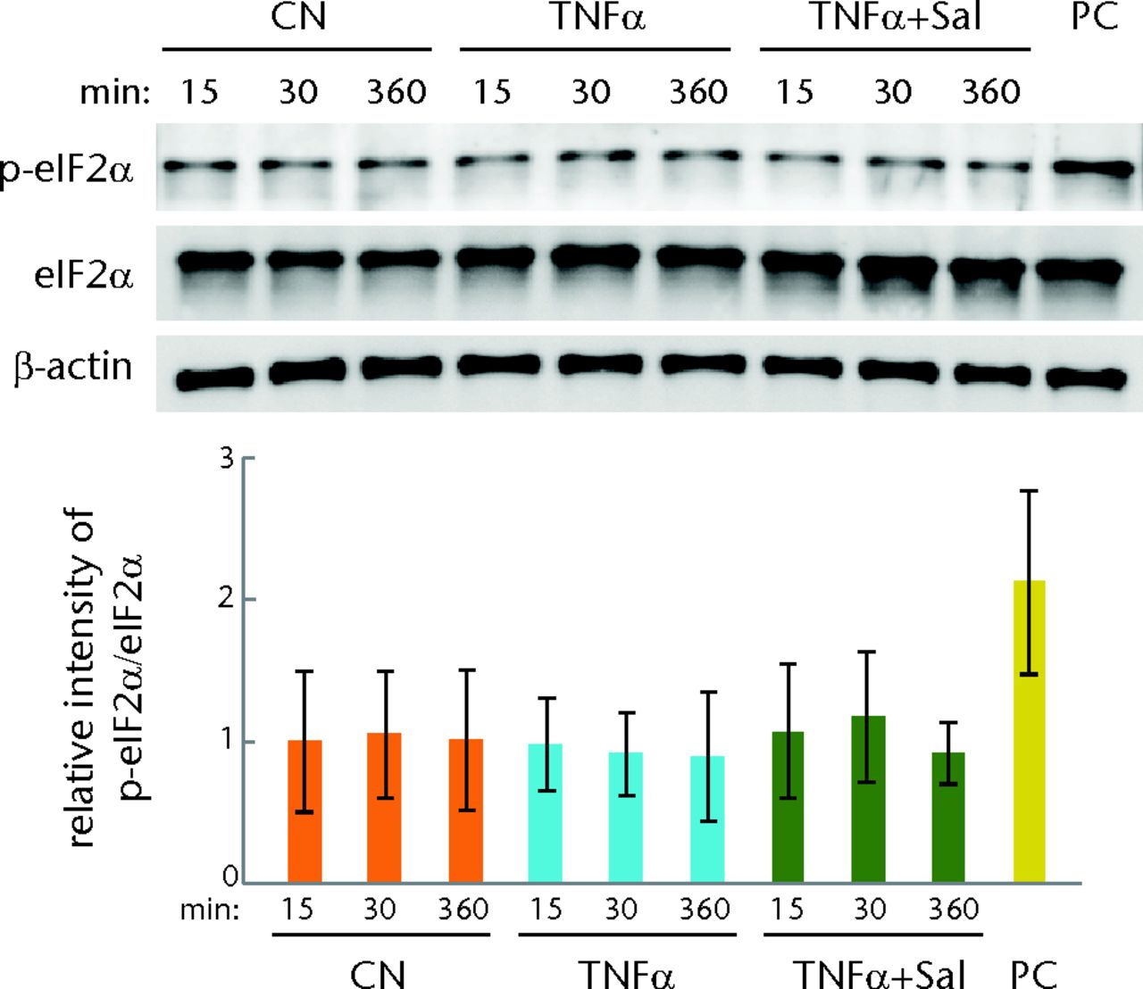 Figs. 6a - 6b 
            Graphs and staining showing evaluation
of the phosphorylation level of eukaryotic translation initiation
factor 2 alpha (eIF2α) in cartilage samples and C28/I2 chondrocytes,
with a) levels of p-eIF2α in tibial cartilage samples (three weeks
after the induction of osteoarthritis; OA); (n = 12 CN, sham control,
10 OA placebo, and 11 OA + Salubrinal (Sal)) and b) levels of p-eIF2α in
C28/I2 chondrocytes treated with TNFα in the presence and absence of
5 µM Salubrinal for 15, 30, and 360 minutes shown. Thapsigargin
at 1 µM was used as a positive control (PC) for p-eIF2α.
          