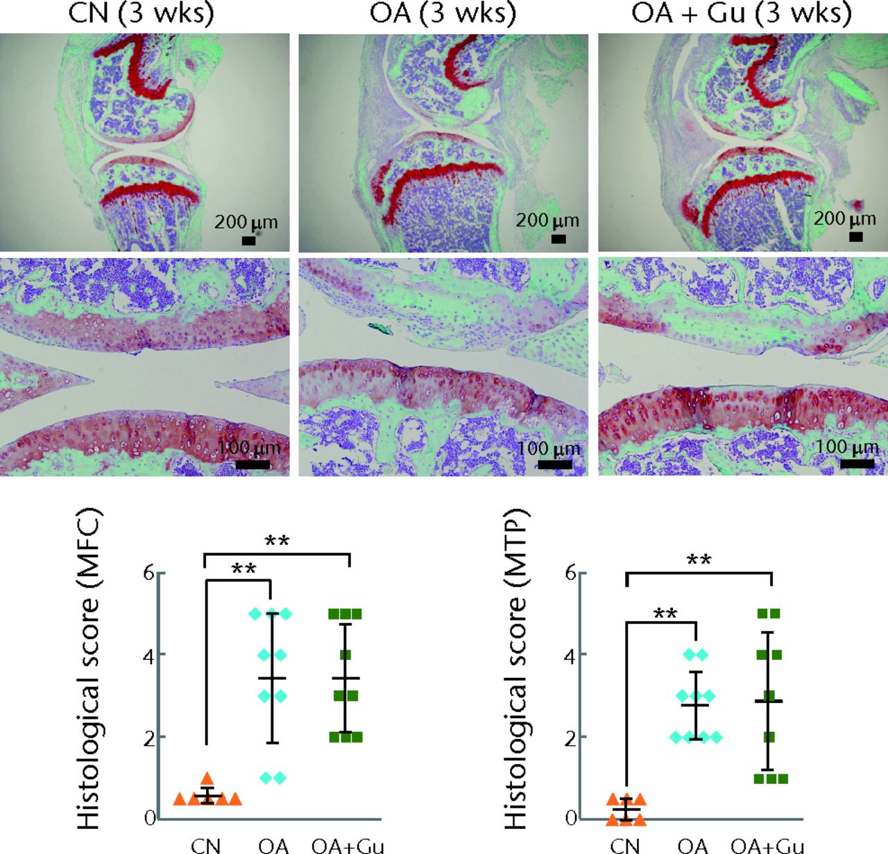 Figs. 7a - 7b 
            Histological images and graphs showing
no significant prevention of the progression of osteoarthritis (OA)
by Guanabenz (Gu). Safranin O staining of the sagittal knee joint
section and histological scores, with a) samples three weeks after induction
of OA; (n = 6 CN, control sham, 9 OA placebo and OA + Gu) and b)
samples six weeks after induction of OA; (n = 5 CN, and 9 OA, and
OA + Gu) shown. OA, OA placebo sample; OA + Gu-treated OA sample.
          