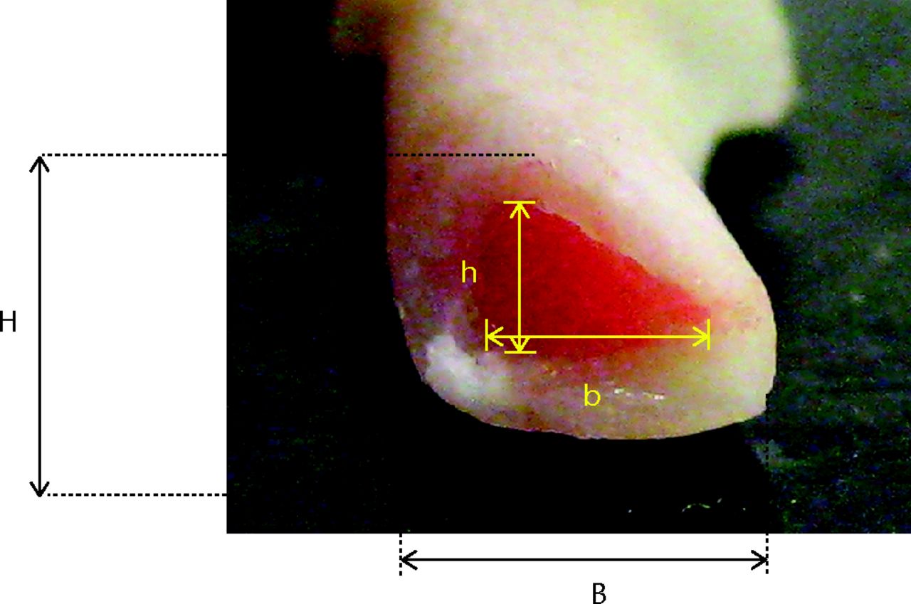 Fig. 2 
          Photograph of triangular cross section
of the tibia. (H, vertical height; B, base length; h, internal vertical
height; b, internal base length.)
        