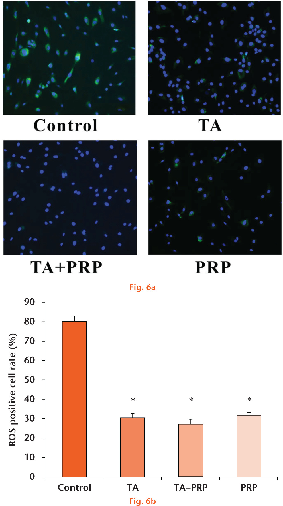  
            Reactive oxygen species analysis; (a) immunofluorescence staining and (b) quantitative analysis (* p < 0.05) (TA triamcinolone acetonide; PRP, platelet-rich plasma)
          