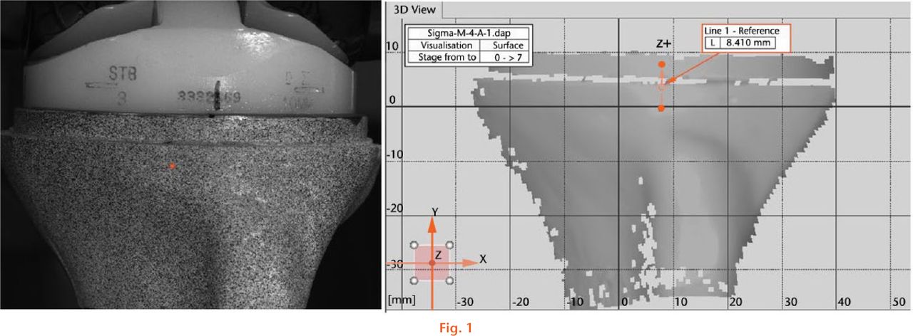 Fig. 1 
          A finely distributed black and white speckle pattern applied to the tibia cortex and the outer rim of the tibial tray. (Right) Three dimensional surface mapping via digital image correlation software allowing spatial tracking of bone and metal reference points.
        