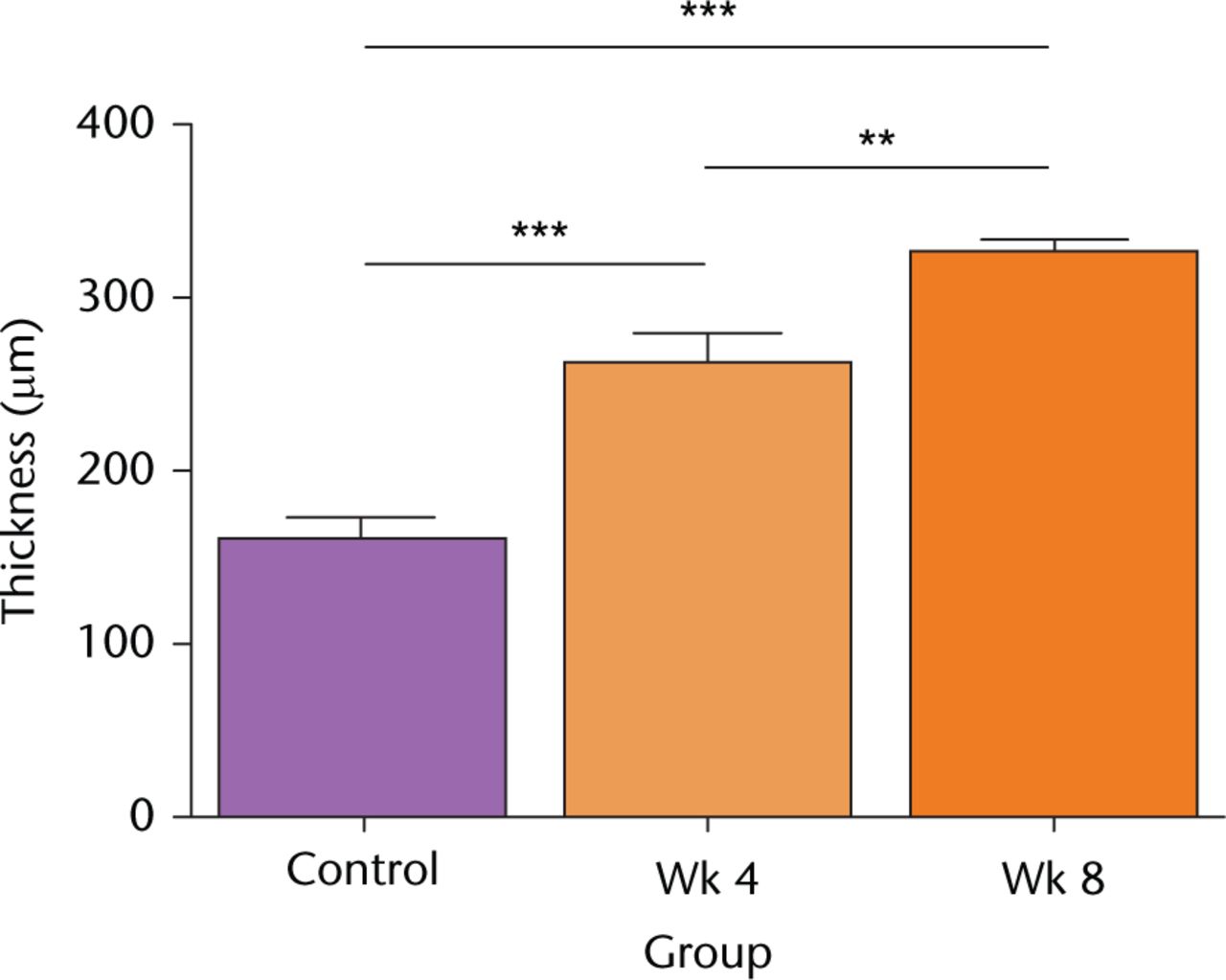 Fig. 2 
            Cartilage thickness following in vivo joint drying. Full-depth cartilage thickness was determined microscopically on histological sections obtained from decalcified joints as described in Materials and Methods. Data are means and 95% confidence intervals for N(n) = 8(12). (Asterisks denote significance levels; *p < 0.05, **p < 0.01, ***p < 0.001).
          