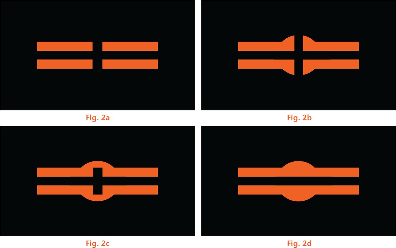  
          Diagrams showing a) a fracture with a fracture line and no callus formation; this would be assigned a radiographic union scale in tibial (RUST) fracture score of 1; b) a fracture with callus formation and a fracture line; this is scored as 2; c) a fracture with bridging callus, but the fracture line is still visible across both cortices; this is scored as 3 and d) complete bridging of the callus with no evidence of fracture line and is scored as 3.
        