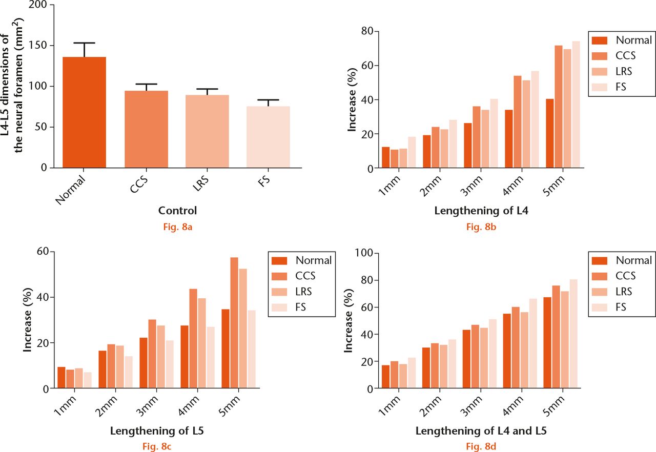  
          Measurements of neural foraminal dimensions (NFD) in the intact state and after 1 mm, 2 mm, 3 mm, 4 mm, or 5 mm pedicle-lengthening at L4 and/or L5: a) the original NFD of control, canal stenosis (CCS), lateral recess stenosis (LRS) and foraminal stenosis (FS) group, NFD was signiﬁcantly larger in the control group compared with the three LSS groups, p < 0.001; b) increased percentage of NFD of control, CCS, LRS and FS group after gradual lengthening of the L4 pedicle by 1 mm, 2 mm, 3 mm, 4 mm, 5 mm, the percentage increase was FS>control>LRS>CCS at 1 mm and FS>CCS>LRS>control at 2 mm to 5 mm, p < 0.001 for all lengthening distance; c) increased percentage of NFD of control, CCS, LRS and FS group after gradual lengthening of the L5 pedicle by 1 mm, 2 mm, 3 mm, 4 mm, 5 mm, the percentage increase was control>LRS>CCS>FS at 1 mm and CCS>LRS>control>FS at 2 mm to 5 mm, p = 0.04 at 1 mm, p = 0.001 at 2 mm, p < 0.001 at 3 mm to 5 mm; d) increased percentage of NFD of control, CCS, LRS and FS group after gradual lengthening of the L4 and L5 pedicle by 1 mm, 2 mm, 3 mm, 4 mm, 5 mm, the percentage increase FS>CCS>LRS>control, p < 0.001 at 1 mm, p = 0.045 at 2 mm, p = 0.04 at 3 mm, p = 0.004 at 4 mm, p = 0.006 at 5 mm.
        