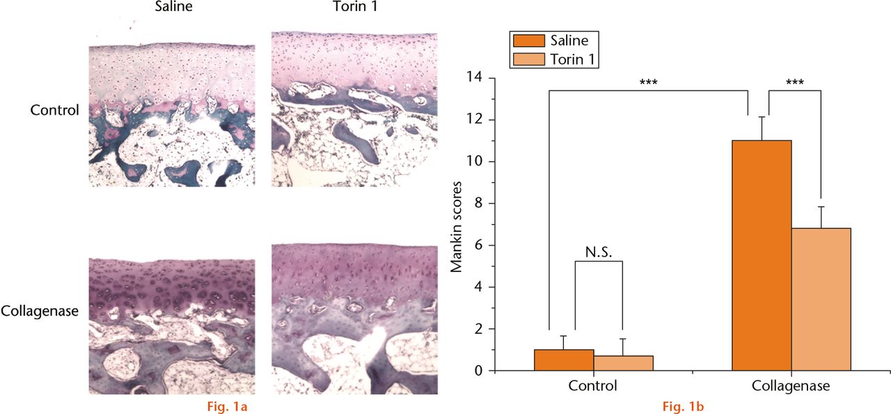  
            Histological evaluation of osteoarthritis: (a) there were no degenerative changes of the cartilage in the knees from control rabbits that were treated with saline or Torin 1. The saline-treated rabbits had loss of cartilage surface, Safranin O staining, and had lesions extending into the radial zone at eight weeks after collagenase injection. In contrast, Torin 1-treated rabbits had abrogated loss of Safranin O staining and chondrocyte disappearance in the transitional zone at eight weeks after collagenase injection, and the cartilage surface was preserved. b) The Mankin scores showed that saline-treated rabbits had a significantly higher score than Torin 1-treated rabbits at eight weeks after induction of OA with collagenase injection. In saline-treated rabbits, the score of the collagenase-induced group was significantly higher than the control group. ***p < 0.001 (Magnification, ×100).
          