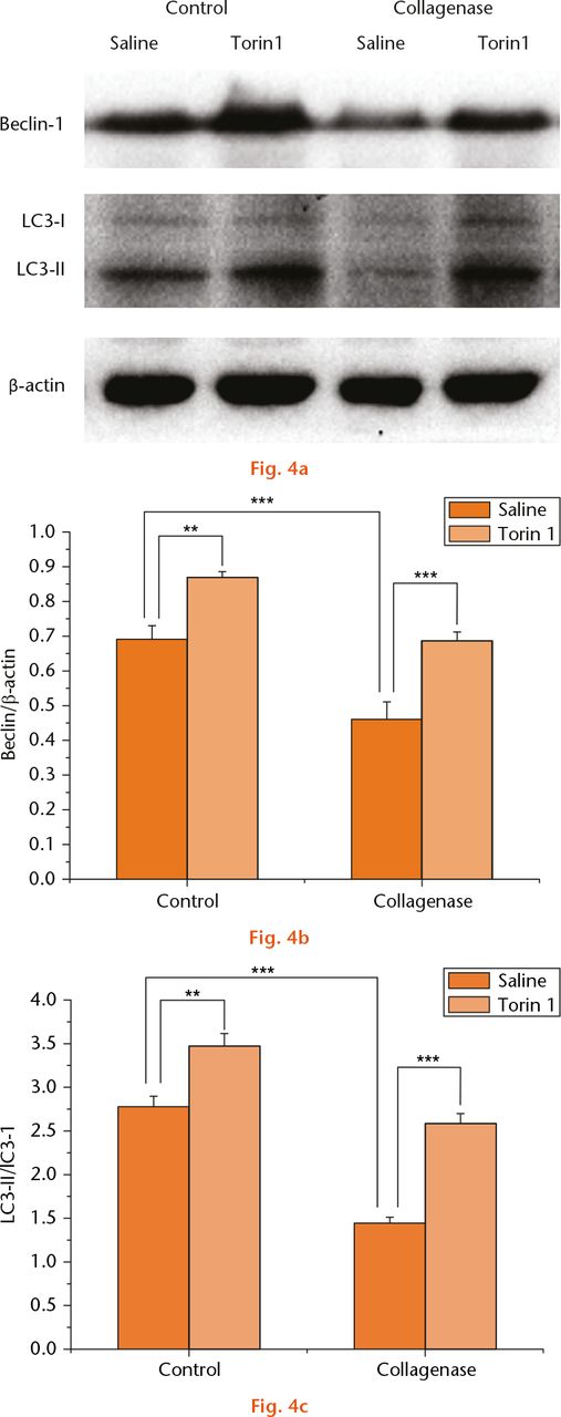  
            Beclin-1 and LC3 expression: a) the expression of Beclin-1 and LC3 evaluated by Western blotting (WB), (b) and (c). The expression of Beclin-1 and LC3 was significantly decreased in saline-treated rabbits at eight weeks post-collagenase injection compared with saline-treated rabbits of the control group. Torin 1 treatment increased Beclin-1 and LC3 expression in control rabbits compared with those treated with saline at eight weeks. Similarly, the expression of Beclin-1 and LC3 was increased in Torin 1-treated rabbits compared with those treated with saline at eight weeks after collagenase injection. **p < 0.01, ***p < 0.001. The WB data were quantified by GEL – DOC 2000 UV GEL imaging system.
          