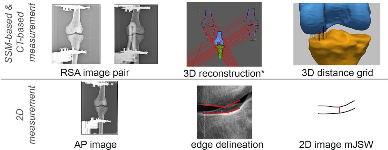 Fig. 1 
            Schematic view of the intermediate steps of the measurement methods. The steps start with the original images and end with the feature that is used to compute the mJSW. *The 3D reconstruction step also includes the model optimisation, which differs between the SSM-based and CT-based measurements.
          