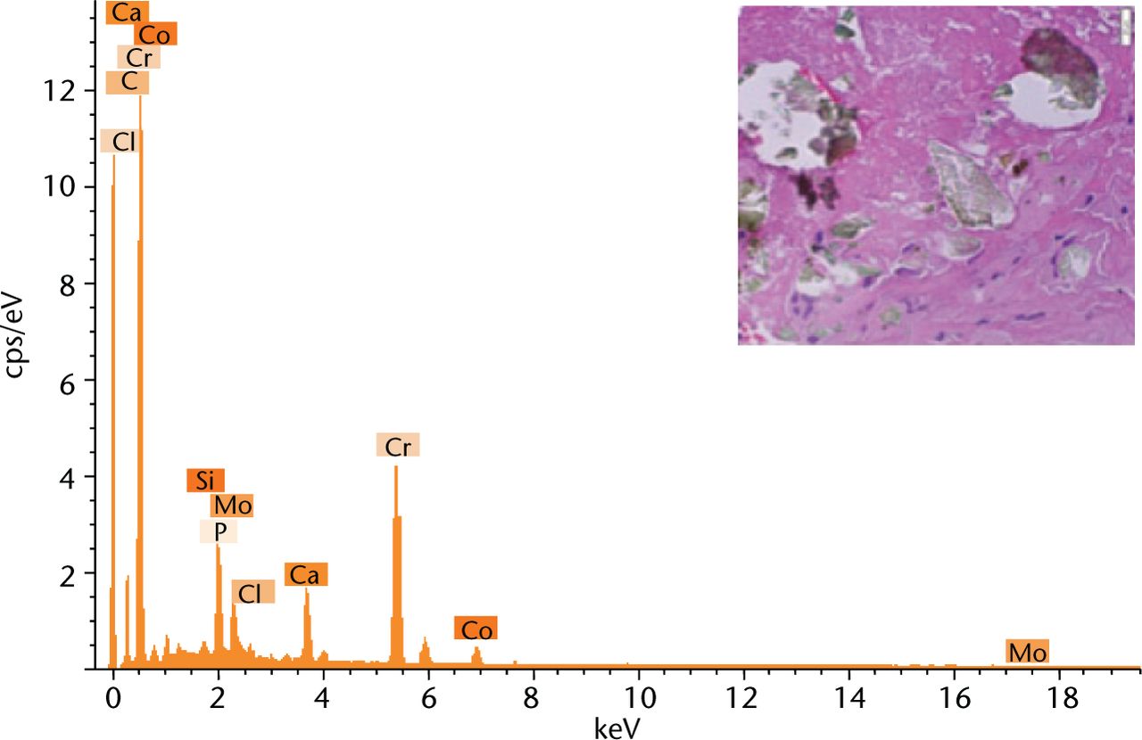 Fig. 4 
            Energy-dispersive x-ray spectrum of the green coloured fragments embedded within the tissue sections as shown in the previous figure by a blue arrow.
          