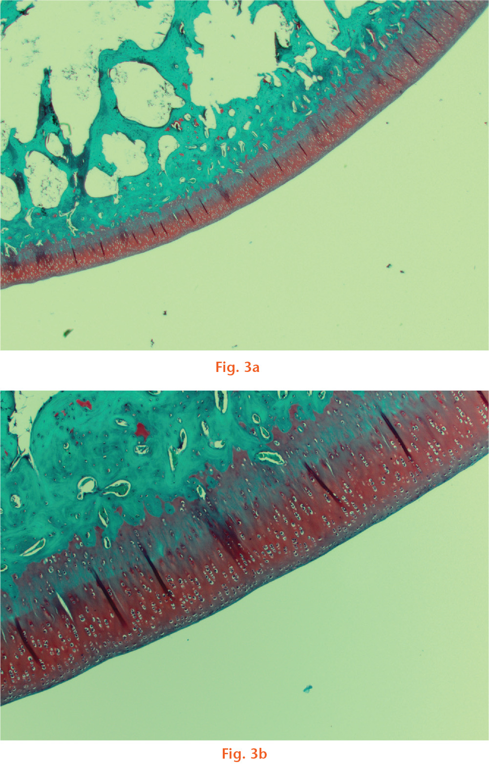  
          Cartilage sample of normal appearance from an animal that underwent arthrotomy alone, 1.25× magnification shown above (a), 4× magnification below (b).
        