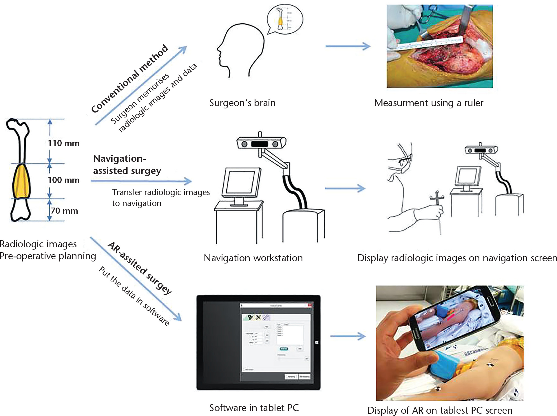 Fig. 1 
          Schematic diagrams of workflows according to the methods for determination of tumour location (AR, augmented reality).
        