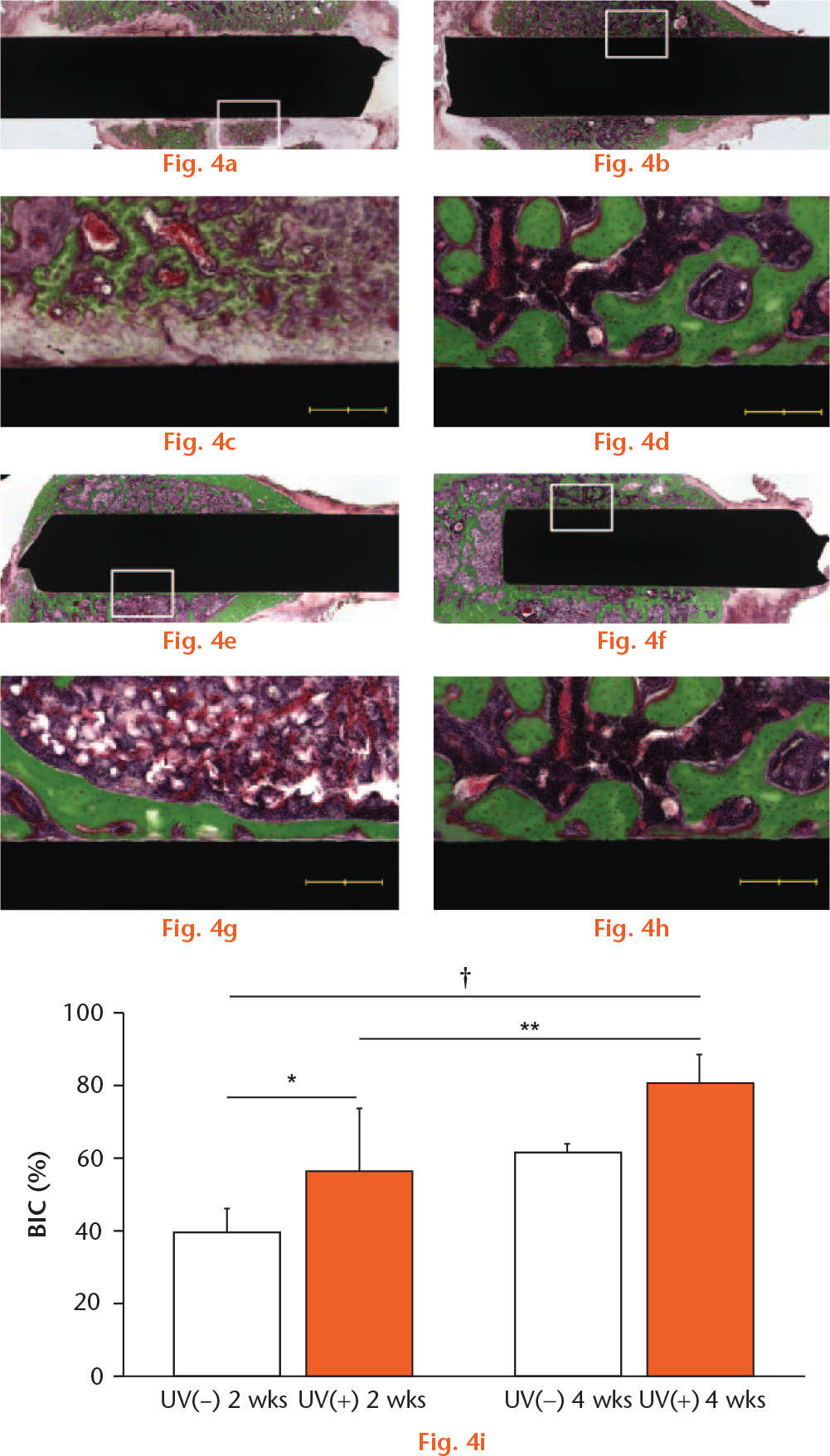  
            Light microscope images (magnification ×4 and ×10, higher magnification images of the boxed areas) two and four weeks after implantation. The micrographs show the bone response for (A, C, E, G) 64Ti(−) and (B, D, F, H) 64Ti(+) implants. Scale bar: 200 μm. (I) BIC ratios for 64Ti(−) and 64Ti(+) were calculated. Results are shown as mean percentage ± standard deviation. p < 0.05, *64Ti(−) vs 64Ti(+), †64Ti(−) 2 w vs 64Ti(+) 4 w (n = 5).
          