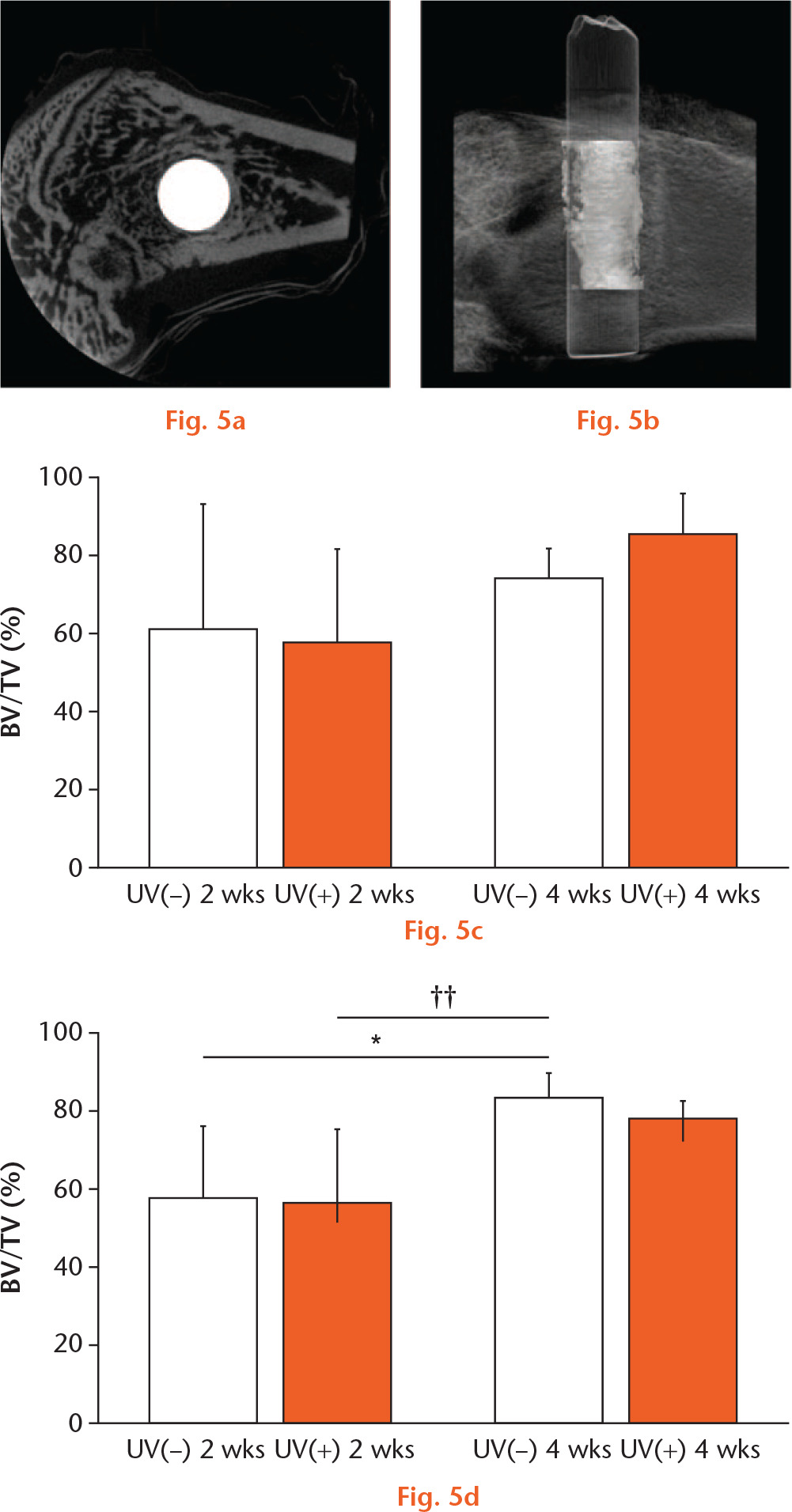  
            BV ratio was calculated using micro CT. a) The image shows a representative cross-sectional microcomputed tomography slice in the perpendicular direction to the longitudinal axis of the implant. Scale bar: 1 mm. b) The image shows a representative three-dimensional computed tomography image around the implant. Scale bar: 2000 μm. BV ratios for c) Ti and d) Ti6Al4V were calculated. Results are shown as mean percentage and standard deviation. p < 0.05, *UV(−) vs UV(+), ††64Ti(−) 2 w vs 64Ti(−) 4 w (n = 5).
          