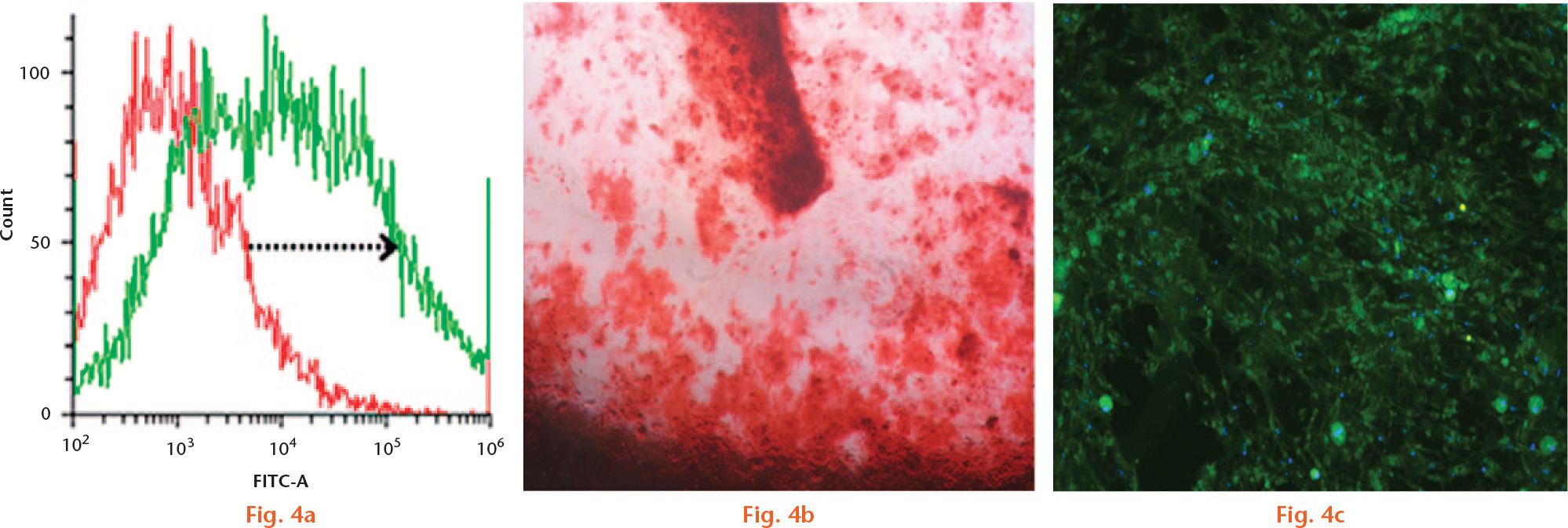  
            Flow cytometry to analyse the chemokine receptor type 4 (CXCR4) expression of rBMCs post osteogenesis. The arrow shows the positive shift of the CXCR4-expressing osteoblasts (a) Positive Alizarin Red (b) and osteocalcin staining (c) expressed at day 21 of osteogenic-differentiated rBMCs.
          