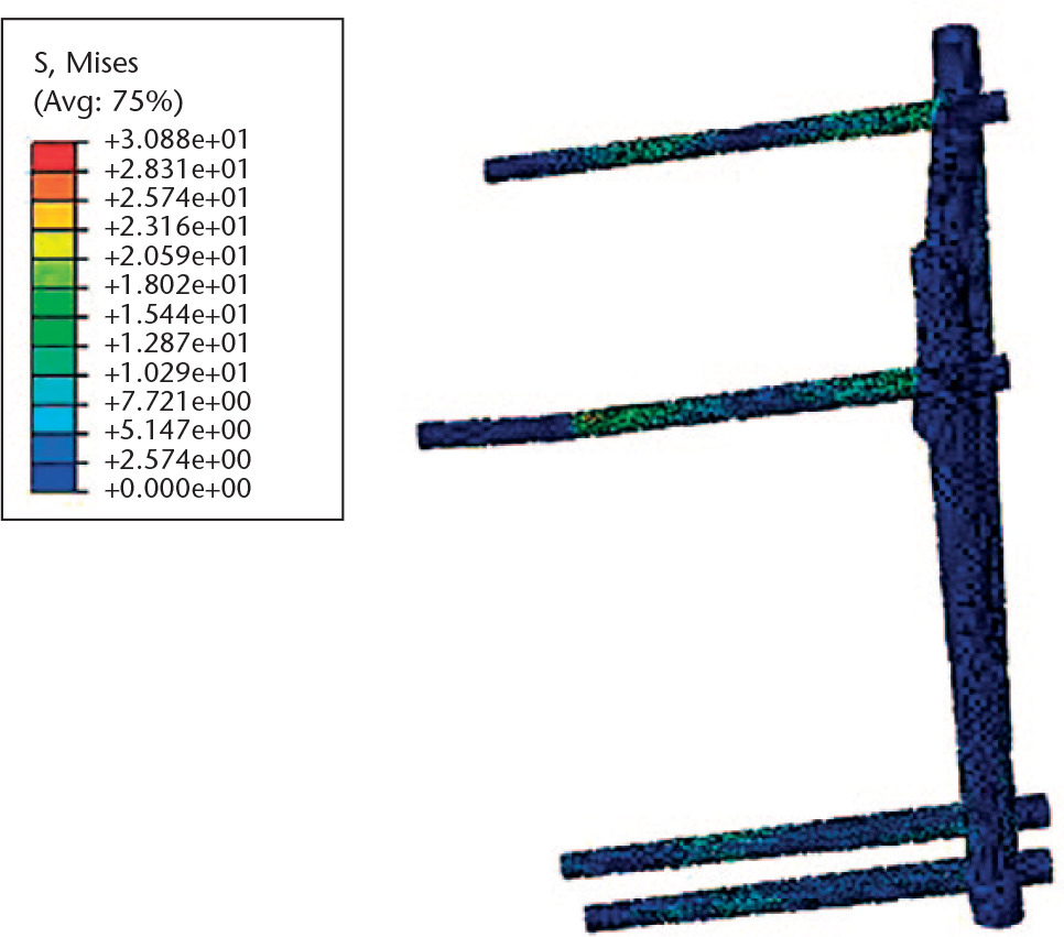 Fig. 3 
            External fixator stress nephogram.
          