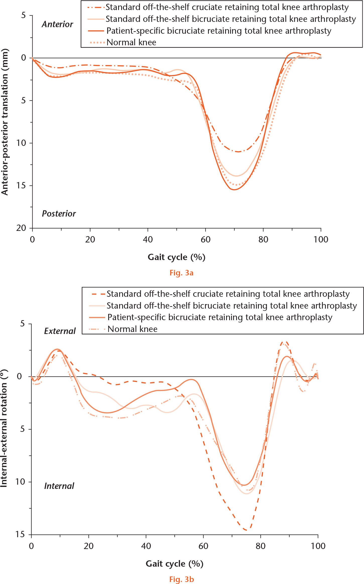  
            Evaluations of a) anterior-posterior tibial translation, and b) internal-external tibial rotation in standard off-the-shelf cruciate-retaining total knee arthroplasty (TKA), standard off-the-shelf bicruciate-retaining TKA, patient-specific bicruciate-retaining TKA and a normal adult knee, under gait loading conditions.
          