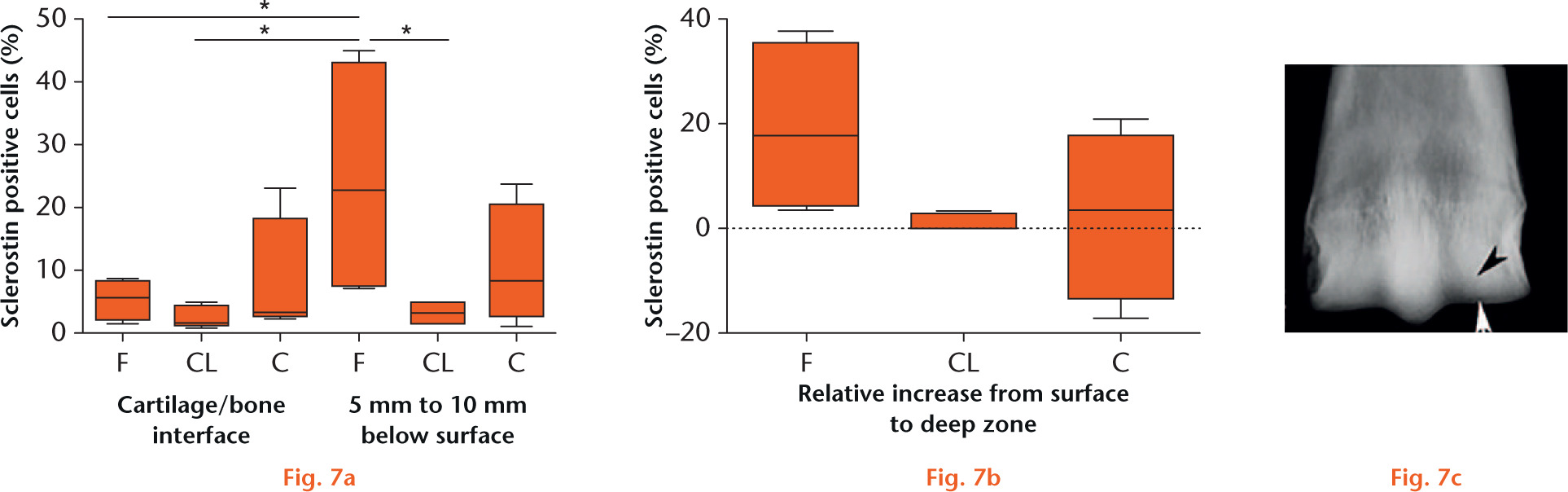  
            Quantification of sclerostin immunohistochemistry within osteocytes in fractured (F), contralateral (CL) and control limbs (C). There is a significant increase (*p < 0.05) in sclerostin immunoreactivity in the deep zone of the fractured bone. In the photograph, the approximate site of the cartilage/bone interface region (white arrow) and the deeper region is indicated (black arrow).
          