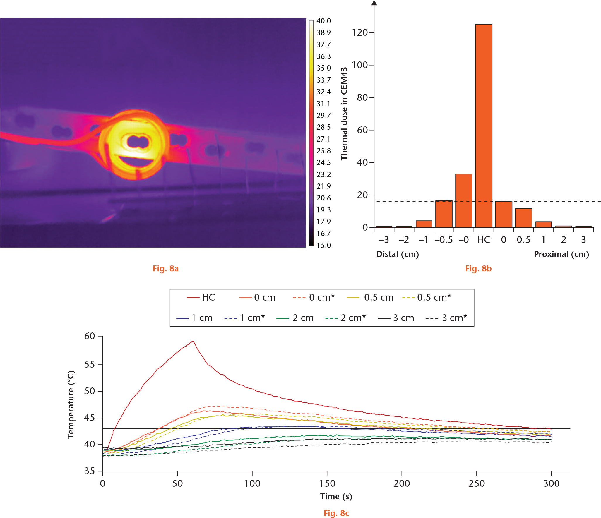  
            Segmental induction heating of locking compression plate (LCP), front view. a) A thermal image from a thermal camera showing selective heating. The vertical lines have 1 cm spacing. b) A graph showing thermal dose in CEM43 at several distances from the heating centre (HC). The dashed line represents 16 CEM43, the threshold for necrosis of bone. c) A graph showing the temperature at several distances from the HC during the segmental induction heating and thereafter. Dashed lines indicate distal direction.
          