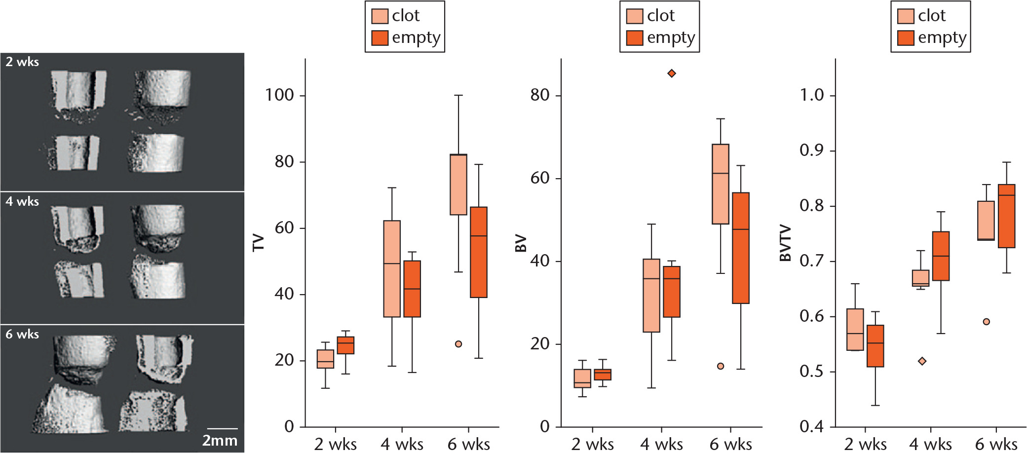  
          In a long bone defect model in a rat femur, gap size 5 mm, stabilized with an external fixator, bone healing was compared between a group with an empty defect and a group receiving an artificial blood clot from allogenic peripheral rat blood (n = 6). Animals were sacrificed after two, four and six weeks, and analyzed with micro-CT to determine the percentage of mineralized tissue. A) 3D images of µCT evaluation, b) tissue volume in mm3 of the volume of interest analyzed by µCT c) bone volume in mm3 of the volume of interest analyzed by µCT d) the quotient of bone and tissue volume of the volume of interest analyzed by µCT. No significant difference was found between the groups, confirming the usability of such a biomaterial to add cells or factors during the early bone healing phase (animal experiments were approved by the local legal representative (G 0428/07) and carried out according to the policies and principles established by the Animal Welfare Act).41
        