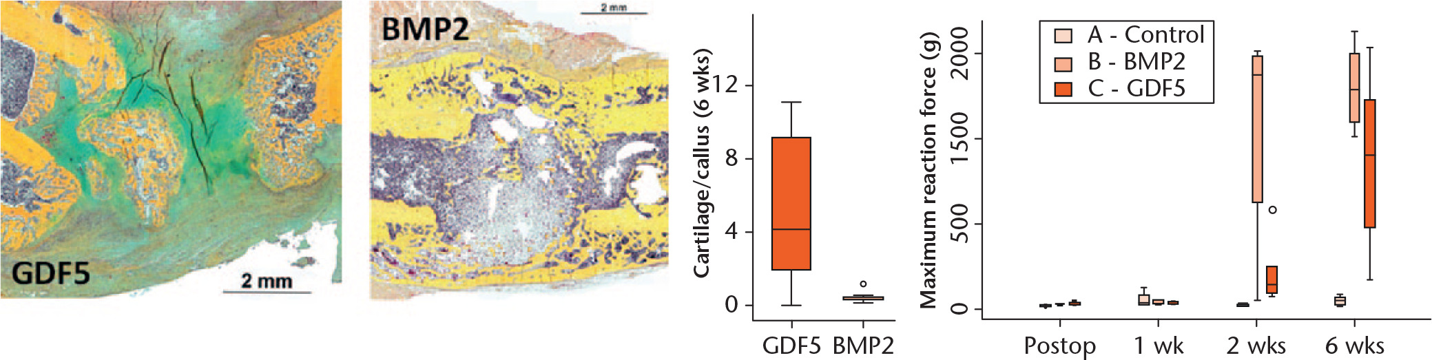  
          a) Growth and differentiation factor 5 (GDF5); b) bone morphogenetic protein (BMP)-2 application. Histological staining was done with Movat pentachrome to depict different tissues: yellow, bone; green, cartilage; orange, muscle; light blue, connective tissue; dark red, bone marrow (adapted from Wulsten et al).57 c) Graph showing that, when applied within a critical-sized defect in a rat femur osteotomy model, GDF5 with a collagen scaffold favoured cartilage formation within the callus after six weeks, as compared with BMP2. d) Graph showing that tissue stiffness within the defect showed solidification after two weeks with BMP, while GDF5 still had not reached bone stability after six weeks of healing. Control confirms the non-healing of this model without growth factor application.
        