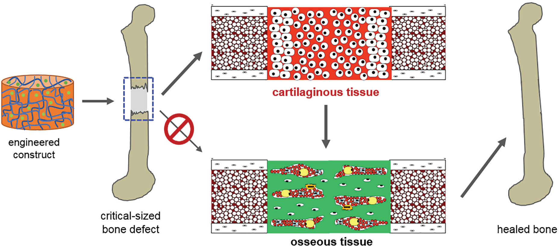 Fig. 2 
          Directing endochondral repair of large bone defects. One paradigm for bone regenerative medicine is modelled on the processes of long bone development and successful (fracture) repair. Instead of designing scaffold/biological constructs for the direct stimulation of osteogenesis, constructs can be engineered to undergo an initial chondrogenesis phase, which serves as an efficient template for ordered osteogenic remodelling by successive waves of repair cells. It is noteworthy that cartilage, an avascular tissue, is more resilient to the vascular deficiency within larger bone defects.
        