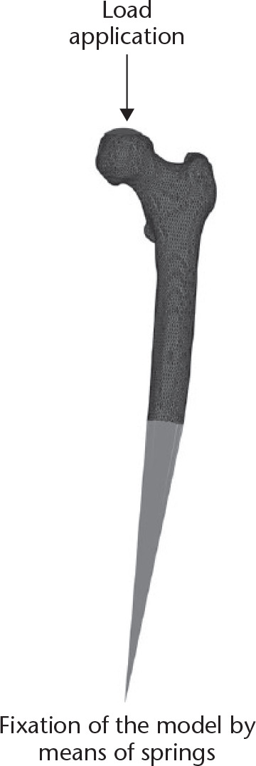 Fig. 1 
            Boundary conditions for the finite element model. The model was distally fixed by springs with a very high stiffness and the load was applied by means of a cup on the head of the femur, which incrementally displaced in a distal direction.
          