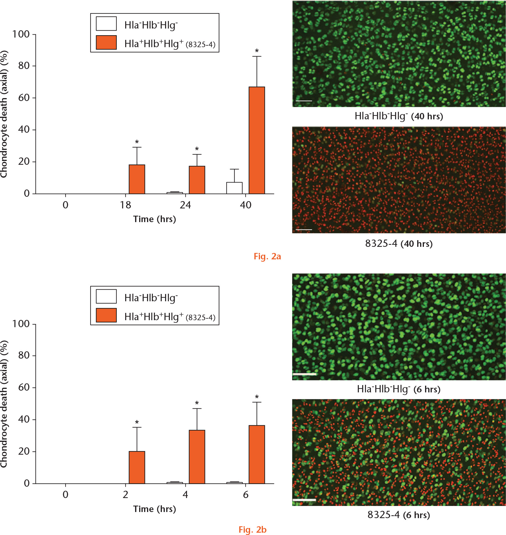  
            Graphs showing the induction of chondrocyte death by Staphylococcus aureus haemolysins. a) Osteochondral explants cultured in the presence of the 8325-4 strain demonstrated significantly greater chondrocyte death at all timepoints. In comparison, chondrocyte death in the presence of the Hla-Hlb-Hlg- strain was minimal (N = 4 (n = 8); *p < 0.05, 8325-4 vs Hla-Hlb-Hlg- strain by Mann–Whitney U test). Confocal laser-scanning microscopy (CLSM) images displayed the marked difference between the two strains at 40 hours. b) Osteochondral explants exposed to the 8325-4 culture supernatant demonstrated rapid and significant chondrocyte death over six hours compared with explants exposed to the Hla-Hlb-Hlg- supernatant (N = 4 (n = 8); *p < 0.05, 8325-4 vs Hla-Hlb-Hlg- supernatant by Mann–Whitney U test). The CLSM images demonstrate the marked difference between the two supernatants at six hours (in this and subsequent figures, the scale bar = 100 µm).
          