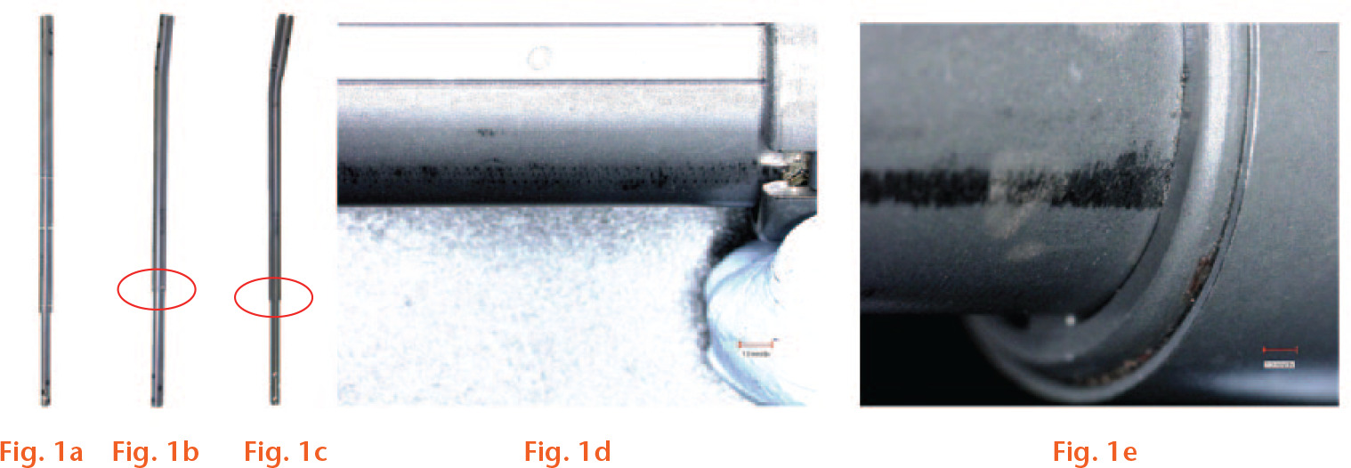  
            a) First-generation nail, shown by the presence of three welds and supported by the lot numbers referred to as P1. b) Second-generation nail, shown by the absence of welds and supported by the lot numbers referred to as P2. c) Second-generation nail, second modification, shown by the absence of welds and crown and supported by the lot numbers, referred as P2.1. d) Part of the crown on the actuator of a retrieved P2 (a magnification of the circled area of Figure 1b). e) Absence of the crown on a retrieved P2.1 nail (a magnification of the circled area of Figure 1c).
          