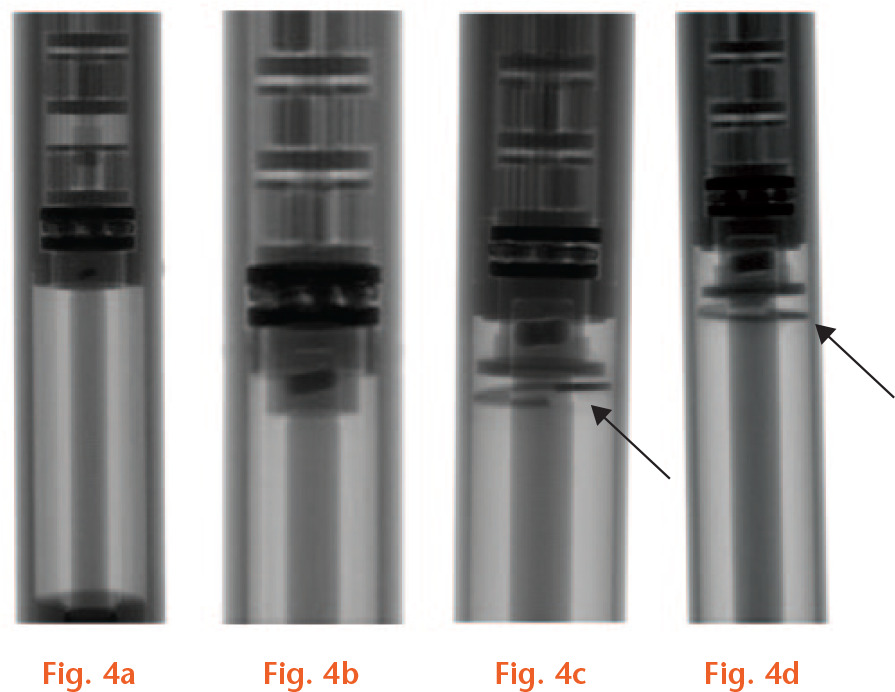  
            Micro-CT of different internal mechanisms/designs. a) Micro-CT of early P1 design with the arrow showing the increased frame. Comparing the pin with the micro-CT scans of the other designs shows a smaller pin, which sectioning revealed a fragment of the pin missing. b) Micro-CT of later P1 design with a larger actuator pin. c) Micro-CT of P2 and d) micro-CT of P2.1 designs revealed a similar internal mechanism. Presence of metal rings is shown with arrows.
          