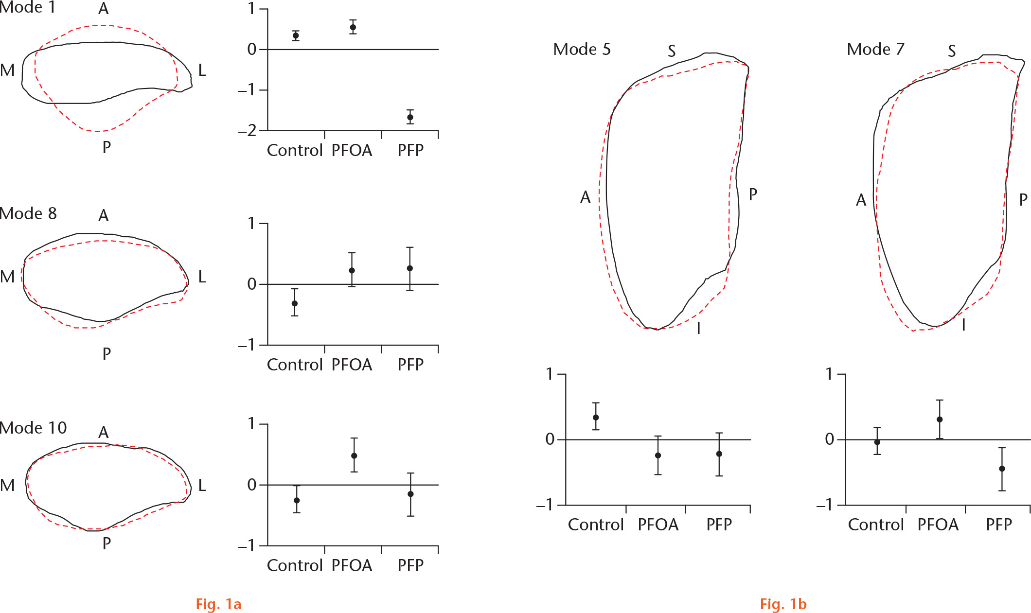  
          a) Skyline and b) lateral modes displayed as -2.5 (dashed red line) and +2.5 (solid black line) standard deviations for visualization purposes. Error bars show mean values of groups (2× standard error) for corresponding modes. Anterior (A), medial (M), lateral (L), posterior (P), superior (S), and inferior (I) locations are defined. PFOA, patellofemoral osteoarthritis; PFP, patellofemoral pain.
        