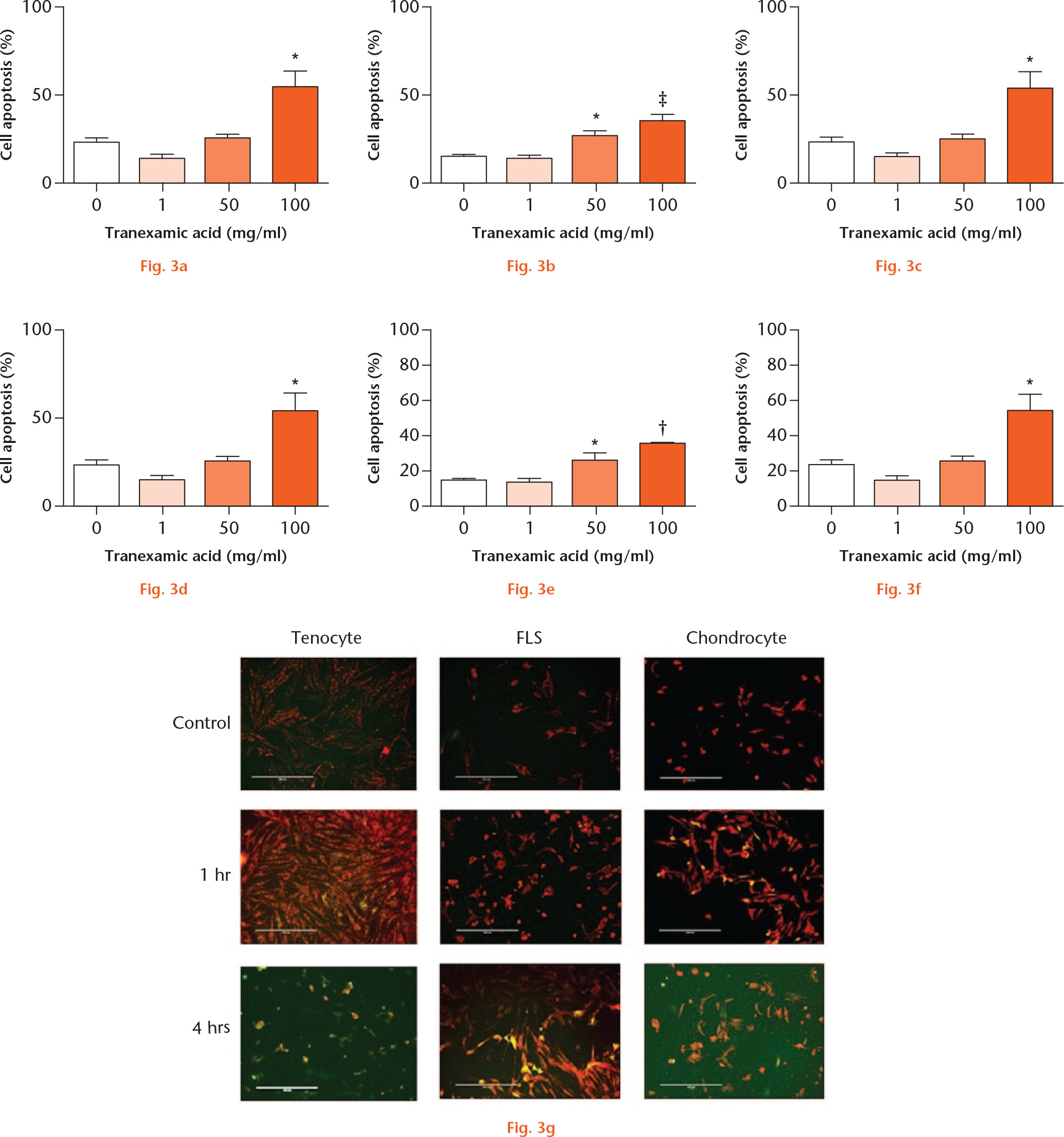  
            Tranexamic acid (TXA)-associated periarticular apoptosis. Percentage of: a) and b) tenocyte (n = 3); c) and d) fibroblast-like synoviocyte (FLS; n = 3); and e) and f) chondrocyte (n = 4) death at a), c), e) one and b), d), f) four hours with 0 mg/ml, 1 mg/ml, 50 mg/ml, or 100 mg/ml TXA treatment. Dying cells (green) were calculated as a proportion of healthy (red) cells. *p < 0.05; †p < 0.01. Data represent mean ± standard error of the mean; one-way analysis of variance; Dunnett’s Multiple Comparison Test. g) Fluorescent microscopy images show tenocytes, FLS, and chondrocytes at: one hour, 0 mg/ml TXA; one hour, 100 mg/ml TXA; and four hours, 100 mg/ml TXA.
          