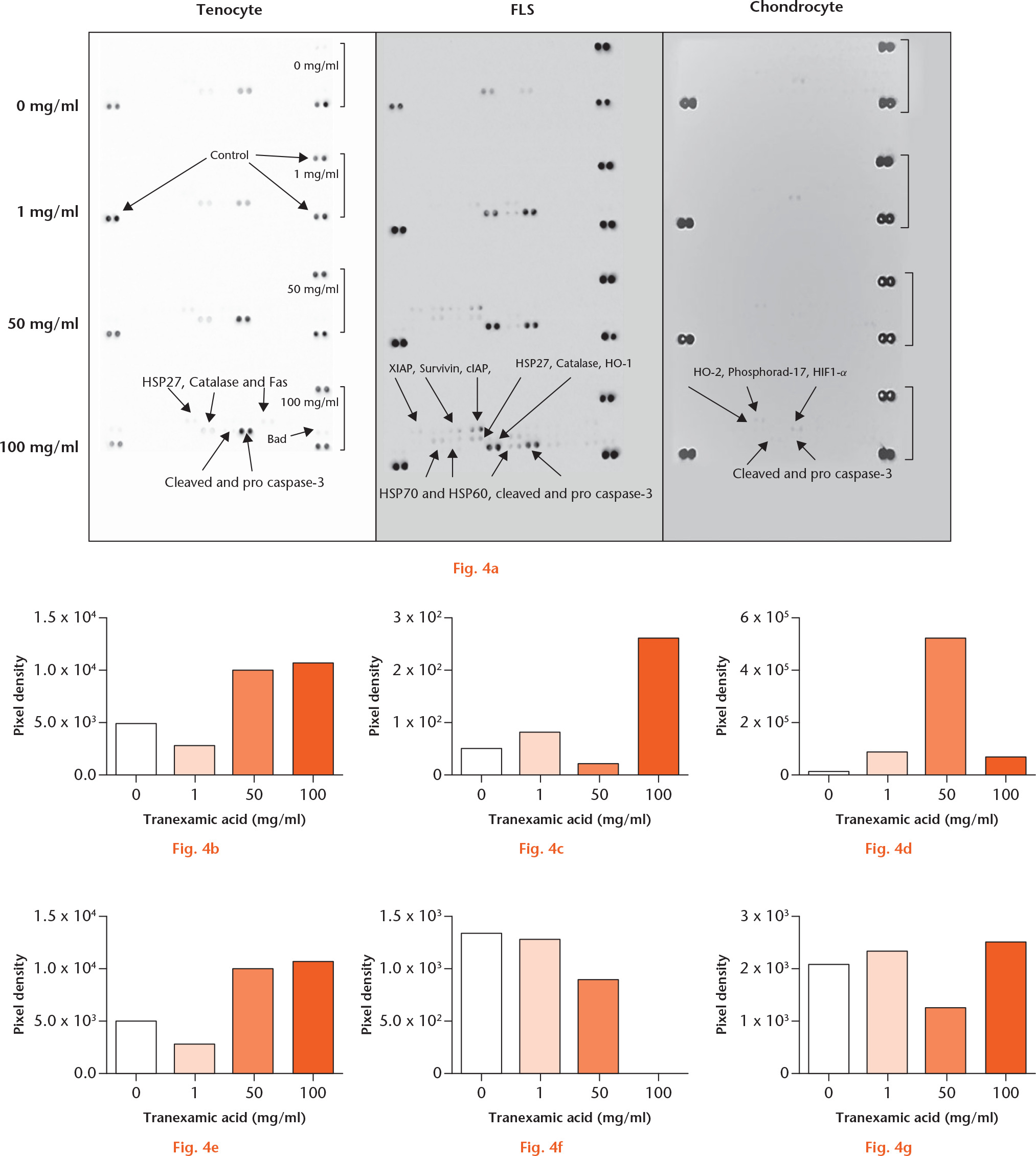  
            a) Tranexamic acid (TXA)-associated periarticular apoptosis pathways. Caspase-3 activation induced by tranexamic acid in vitro in periarticular tissues: b) and c) tenocyte; d) and e) fibroblast-like synoviocyte (FLS); and f) and g) chondrocyte single-sample multi-protein apoptotic arrays. b), d), f) Pro caspase-3 and c), e), g) cleaved caspase-3 samples were treated with 0 mg/ml, 1 mg/ml, 50 mg/ml, or 100 mg/ml of TXA for one hour. Pro and cleaved forms of caspase-3 signal pixel density plotted relative to control spots. HSP, heat shock protein; XIAP, X-linked inhibitor of apoptosis protein; cIAP, cellular inhibitor of apoptosis protein; HO-1, heme oxygenase 1; HIF1-α, hypoxia-inducible factor 1-alpha.
          