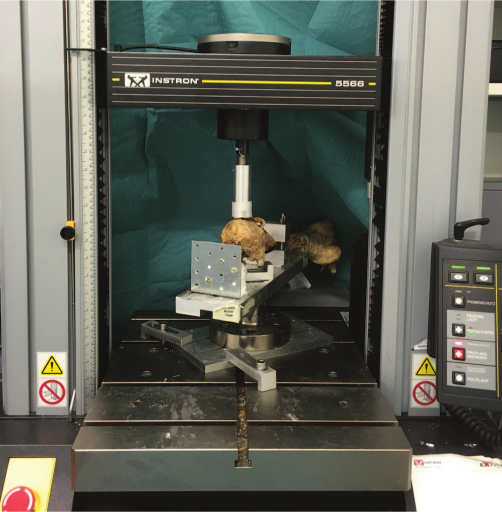 Fig. 1 
            Photograph showing the biomechanical setting for producing a periprosthetic femoral fracture.
          