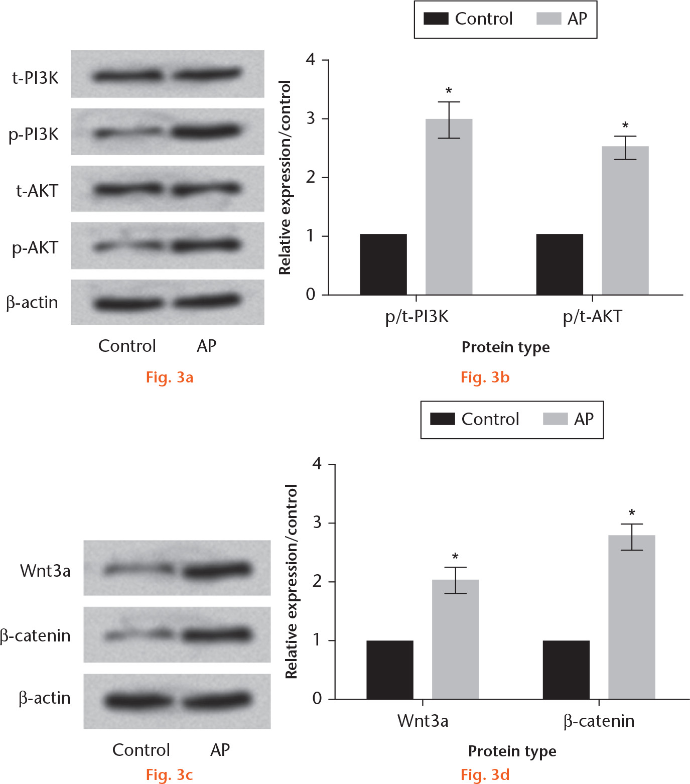 Fig. 3 
            Effect of angelica polysaccharide (AP) on phosphatidylinositol 3-kinase (PI3K)/protein Kinase B (AKT) and Wnt/β-catenin signalling pathways. Mesenchymal stem cells (MSCs) were stimulated with 300 μg/ml of AP, and untreated cells served as the control group. The protein levels of a) and b) phospho (p)/total (t)-PI3K and phospho (p)/total (t)-AKT, and c) and d) Wnt3a and β-catenin were determined by western blot assay. *p < 0.001.
          