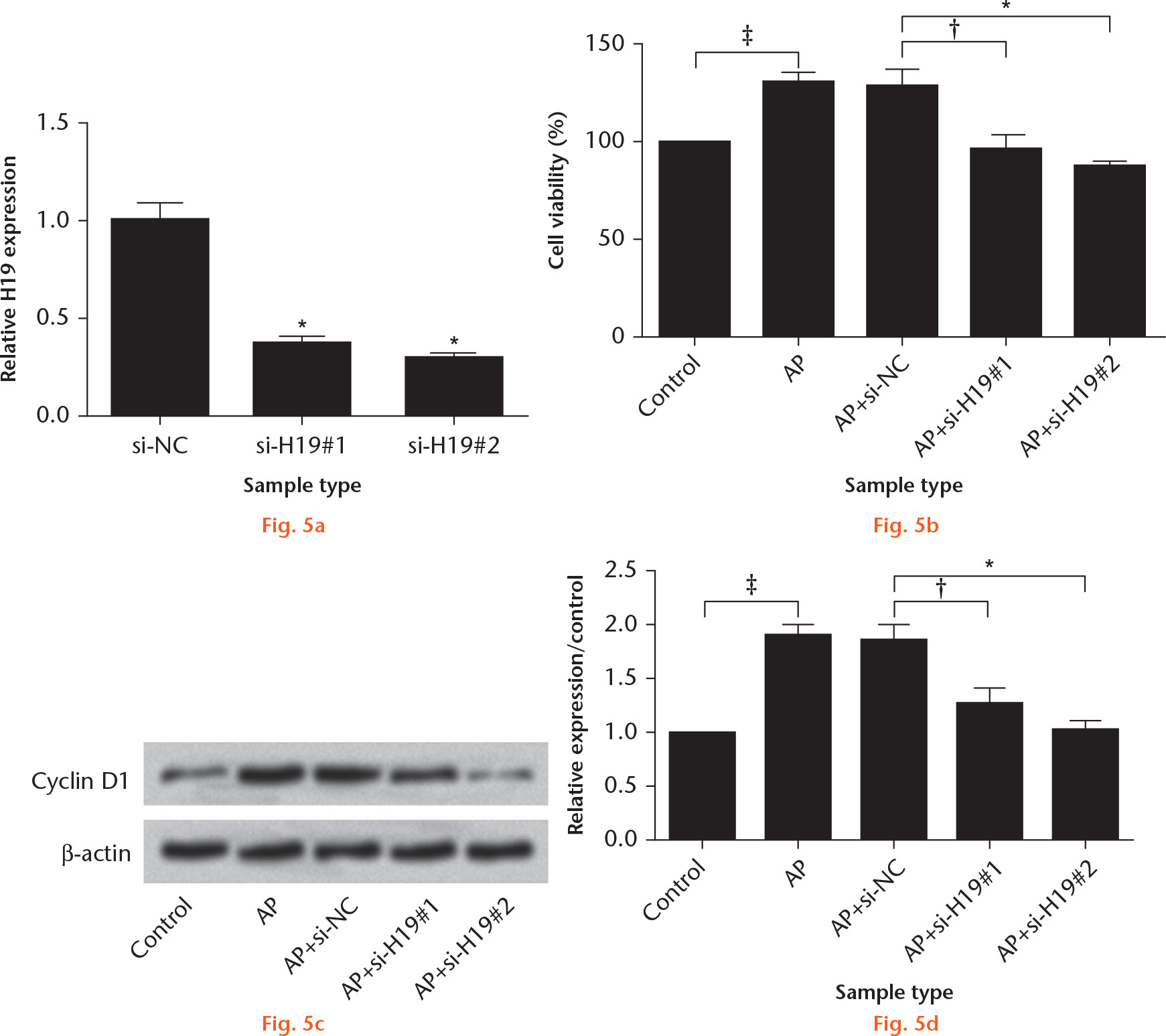 Fig. 5 
            Effect of H19 knockdown on cell proliferation in angelica polysaccharide (AP)-treated mesenchymal stem cells (MSCs). a) MSCs were transfected with si-H19#1 and si-H19#2, and MSCs transfected with si-NC served as the control group. The relative expression level of H19 was determined by reverse transcription-quantitative polymerase chain reaction (RT-qPCR); after transfection and treatment, b) cell viability and c) and d) protein level of cyclin D1 were assessed by Cell Counting Kit-8 (CCK-8) and western blot assays, respectively. *p < 0.01, †p < 0.05: AP+si-H19#1 or #2 versus AP+siNC; ‡p < 0.05: AP versus control.
          