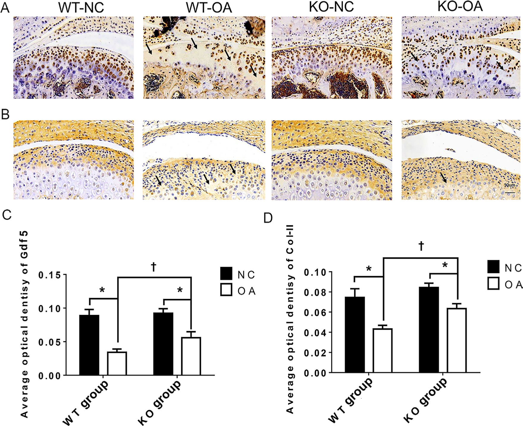 Fig. 3 
            Immunohistochemistry (IHC) changes assessed after osteoarthritis (OA) treatment and the microRNA miR21-5p (MiR21) knockout (KO). a) and b) Representative sections (magnification: 30×) of IHC staining for a) growth differentiation factor 5 (Gdf5) and b) type II collagen (Col-II) in cartilage from wild-type (WT) and KO mice with or without OA induced by unilateral anterior crossbite (UAC). The arrows indicate areas of degraded cartilage, manifested by local loss of Gdf5 and Col-II. c) and d) Average optical density (AOD) of Gdf5 and Col-II protein expression in cartilage. The data are represented as the means ± standard error of the mean (SEM) (n = 10 mice per group). Two-way analysis of variance (ANOVA) corrected with the Bonferroni correction was used to identify significant differences in multiple comparisons. Asterisk (*) and dagger (†) symbols represent p-values < 0.05. *Comparing between NC and OA groups; †comparing between WT-OA and KO-OA groups. Scale bar: 50 μm. NC, control.
          