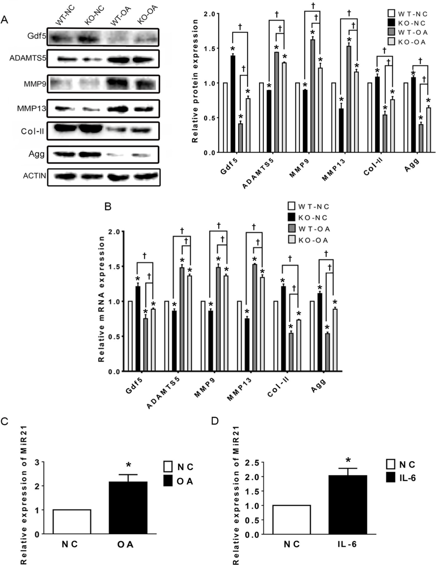 Fig. 4 
            Relative expression levels of the microRNA miR21-5p (MiR21), growth differentiation factor 5 (Gdf5), and related osteoarthritis (OA) molecules in temporomandibular joint (TMJ) cartilage after OA treatment and MiR21 knockout (KO), as assessed by western blotting and quantitative real-time polymerase chain reaction (RT-qPCR). a) Western blot and b) RT-qPCR results of Gdf5, a disintegrin and metalloproteinase with thrombospondin motifs 5 (ADAMTS5), matrix metalloproteinase 9 (MMP9) and MMP13, type II collagen (Col-II), and aggrecan (Agg) protein and messenger RNA (mRNA) expression in cartilage. c) and d) RT-qPCR results of MiR21 mRNA expression in cartilage of temporomandibular joint osteoarthritis (TMJ-OA) induced by c) unilateral anterior crossbite (UAC) and d) in mandibular condylar chondrocytes (MCCs) stimulated by interleukin-6 (IL-6). The data are represented as the means ± standard error of the mean (SEM) (n = 10 mice per group). Two-way analysis of variance (ANOVA) with the Bonferroni correction was used to identify significant differences between two groups. The asterisk (*) and dagger (†) symbols indicate p-values < 0.05. *Comparing between NC and other groups; †comparing between KO-OA group and WT-OA or KO-NC group. NC, control.
          