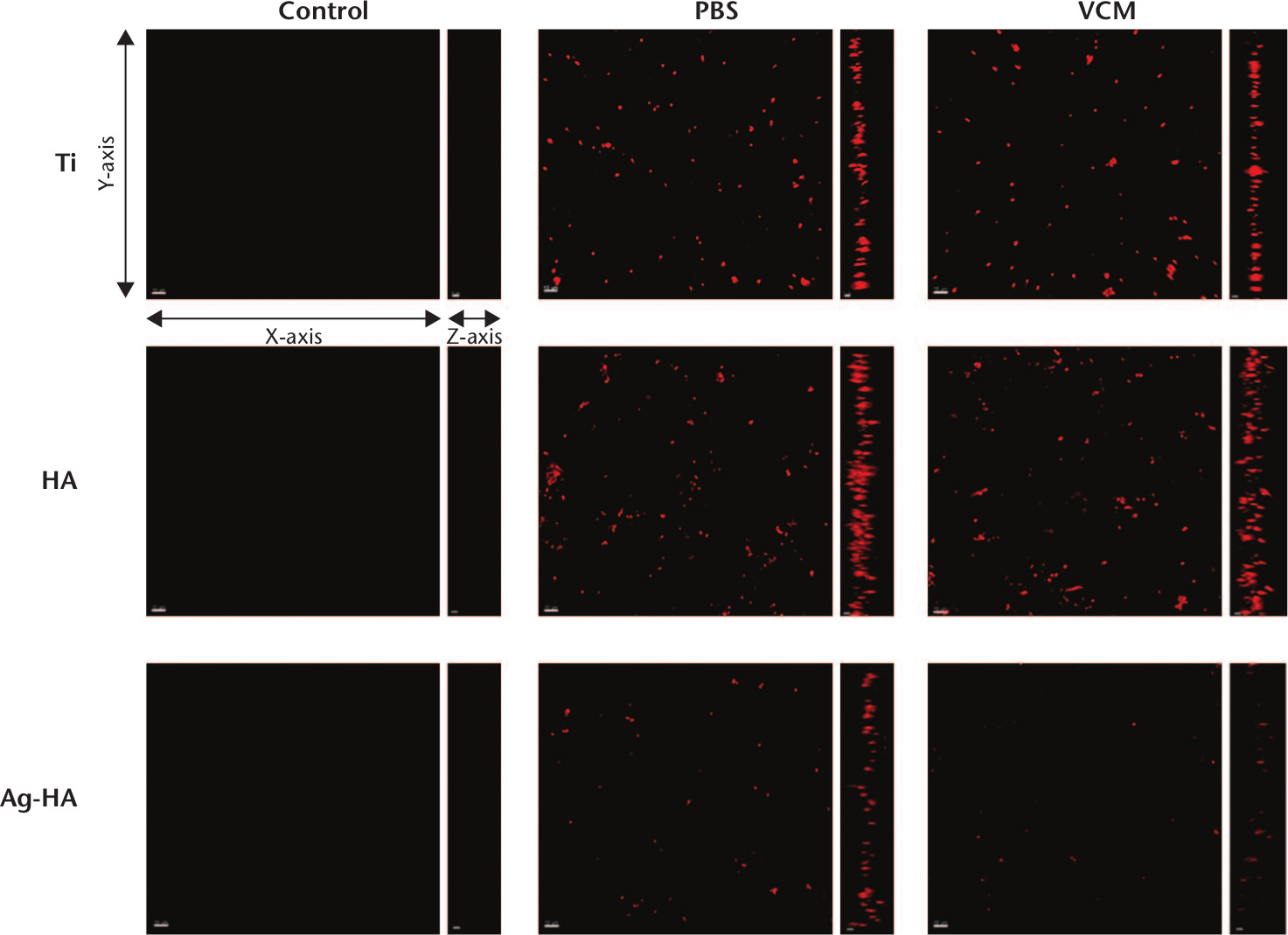 Fig. 5 
            Confocal laser scanning microscopy (CLSM) images of calcein red-orange–stained methicillin-resistant Staphylococcus aureus (MRSA) on discs. The bacteria growth from the following groups are shown: negative control of titanium (Ti), hydroxyapatite (HA) and silver-HA (Ag-HA), Ti phosphate-buffered saline (Ti PBS), Ti vancomycin (Ti VCM), HA PBS, HA VCM, Ag-HA PBS, and Ag-HA VCM. The biofilms were observed with a 20× air objective lens and a zoom factor of 2.0. The scale bars on the x and y axes are 10 µm, whereas that on the z-axis is 5 µm. The staining intensities of the biofilms are in this order: Ag-HA VCM < Ag-HA PBS < Ti VCM < Ti PBS < HA VCM < HA PBS.
          