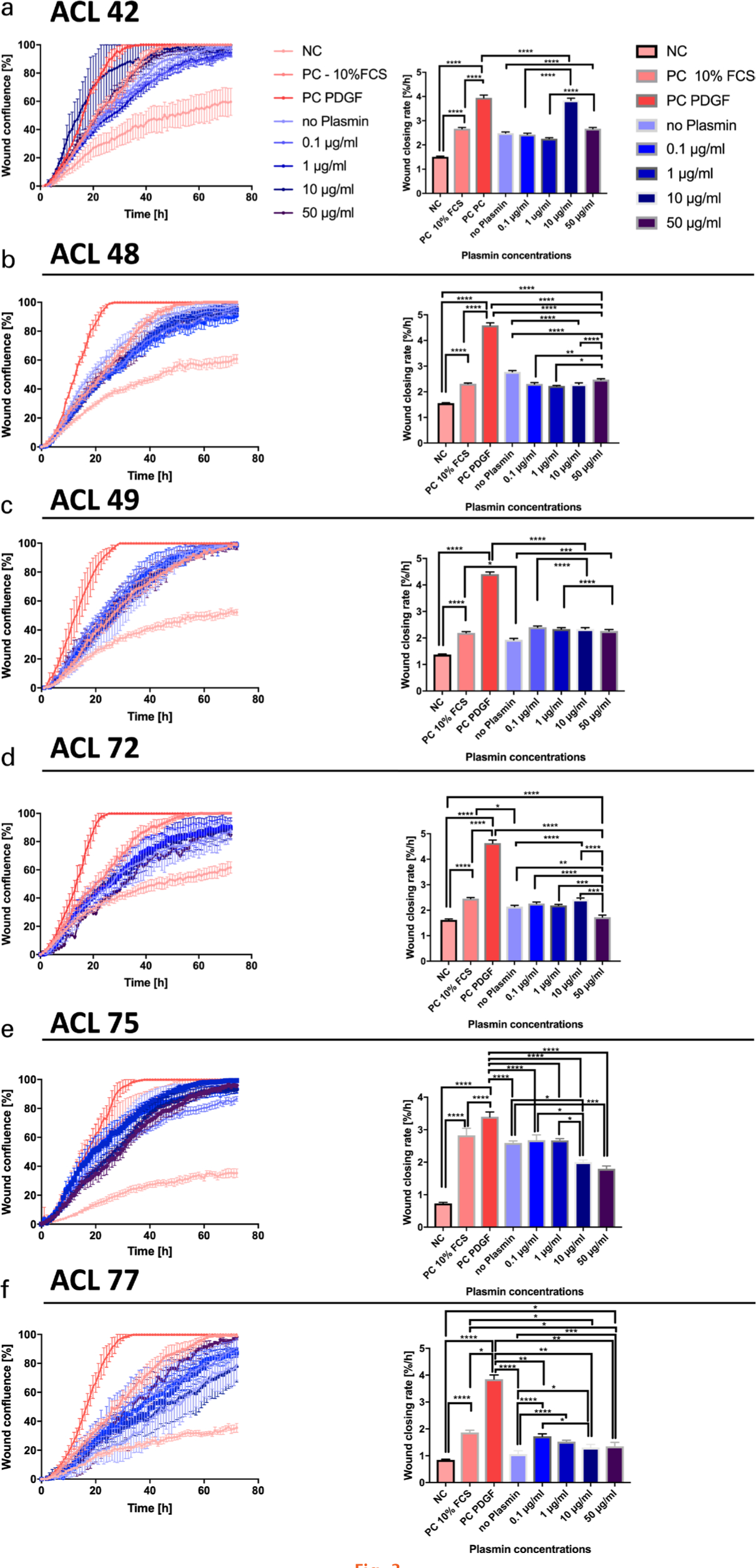 Fig. 3 
            Statistical comparisons of slopes of the least-square fitted linear regressions, defined as wound closing rate (WCR) of the wound scratch assays. a) to f) Wound confluence over time for anterior cruciate ligament (ACL)-derived ligamentocytes (ACL-LCs) of each of the six different donors: on the left side wound confluency is presented for the 72-hour period; on the right side the estimated slopes after 24 hours are shown for the nine technical replicates for each assay. The signiﬁcance from pairwise testing is stated as follows: non-signiﬁcant (ns) p > 0.05, *p ≤ 0.05, **p ≤ 0.01, ***p ≤ 0.001, ****p ≤ 0.0001. FCS, fetal calf serum; NC, negative control; PC, positive control; PDGF, platelet-derived growth factor.
          