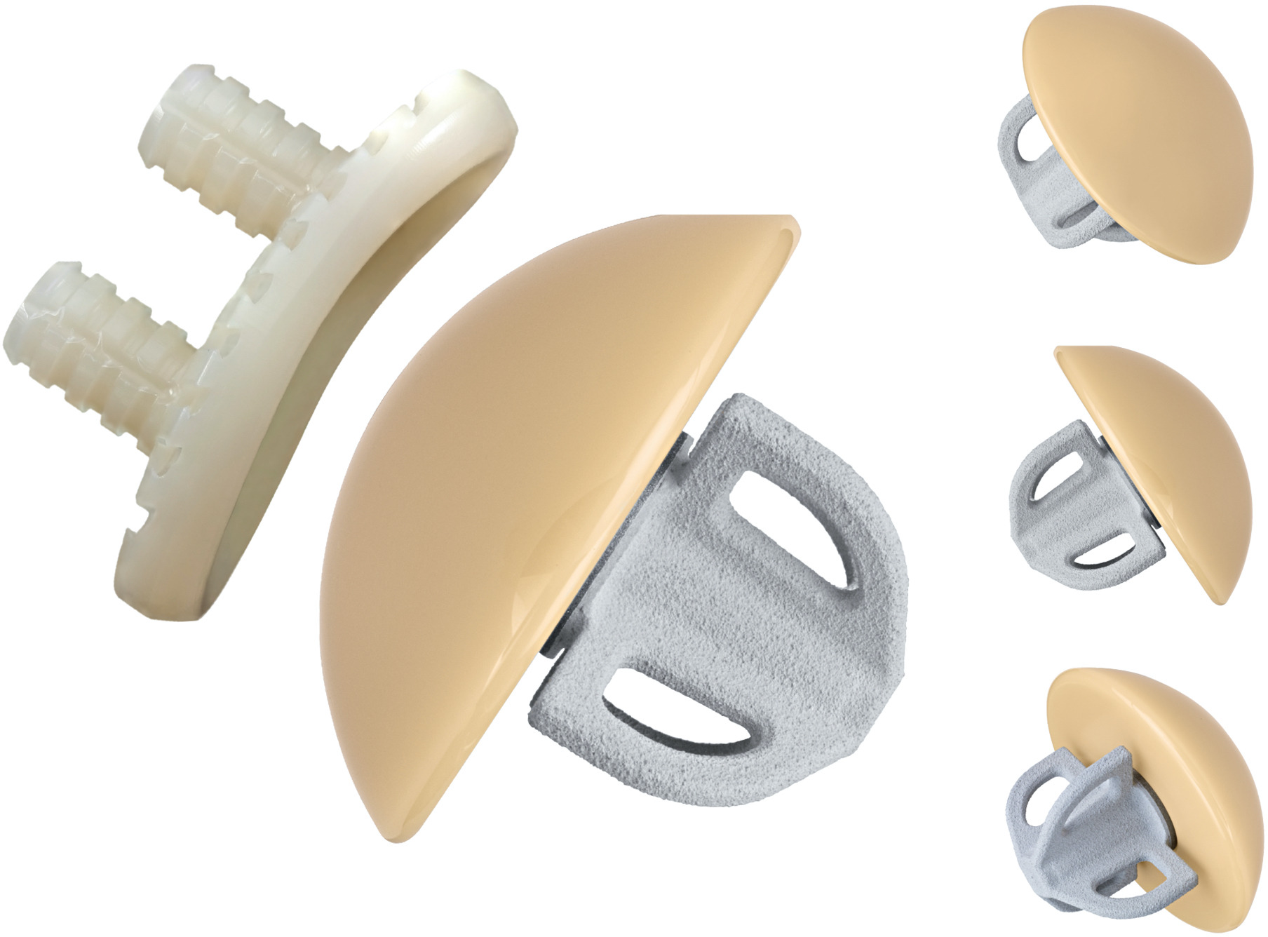 Fig. 1 
            Mathys Affinis Short, Short Stem Total Shoulder Prosthesis.
          