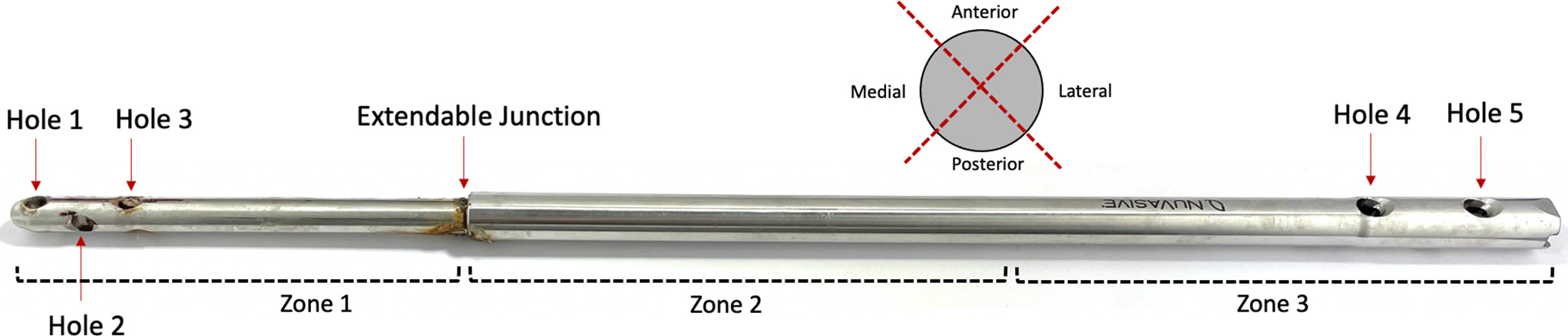 Fig. 2 
            The presence and severity of surface damage was graded for each nail, separated visually into their anterior, posterior, medial, and lateral sides and into their extendable and housing sections. Corrosion grading was performed for each screw hole and the extendable junction of the nails, as labelled.
          