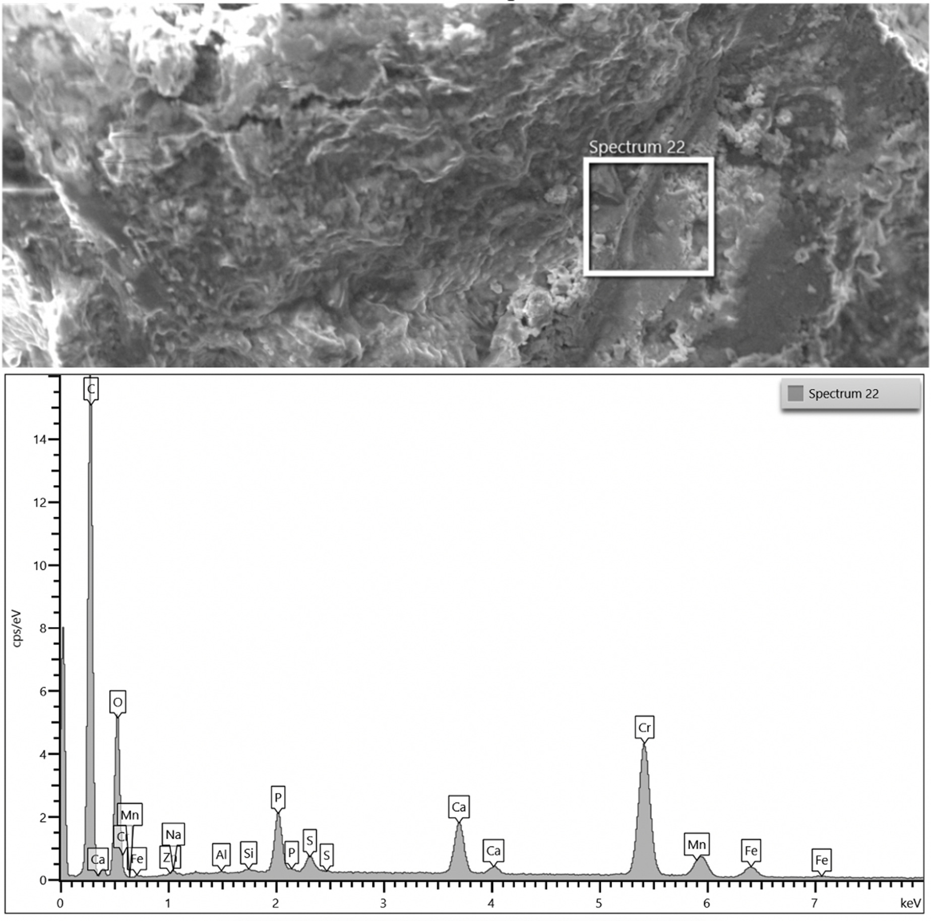 Fig. 8 
            Elemental composition of black surface deposits present on the retrieved nails, as determined using energy dispersive x-ray spectroscopy analysis. The example shown here is of a spectrum from debris around the extendable junction of the left nail from Patient 3. There was evidence of chromium, phosphorous, sulphur, oxides, and chromium, along with the other constituent elements in this alloy.
          