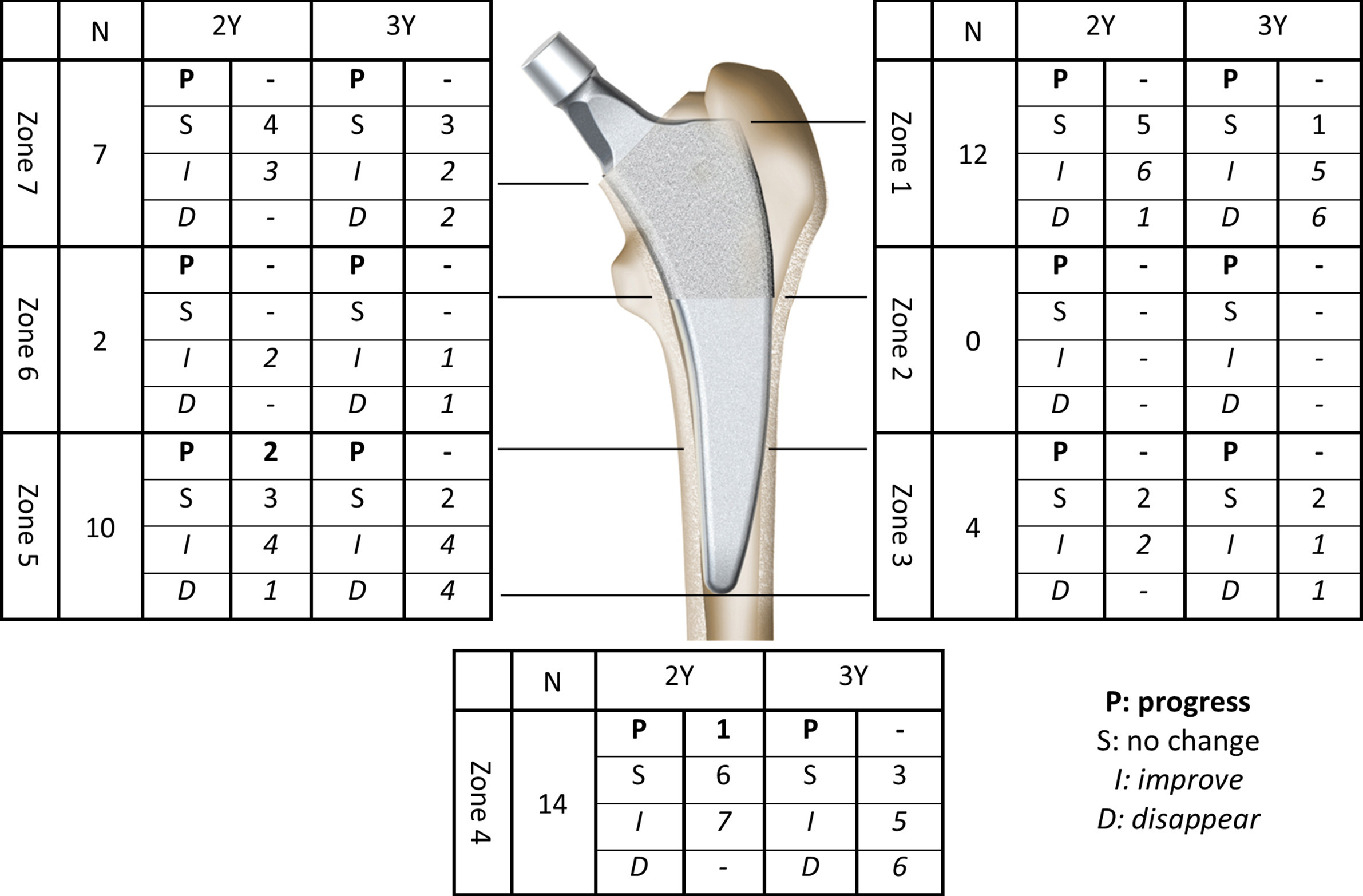 Fig. 4 
          Changes of radiolucent lines at each Gruen zone when compared to one-year postoperative radiograph. This figure has been provided courtesy of Zimmer Biomet.
        