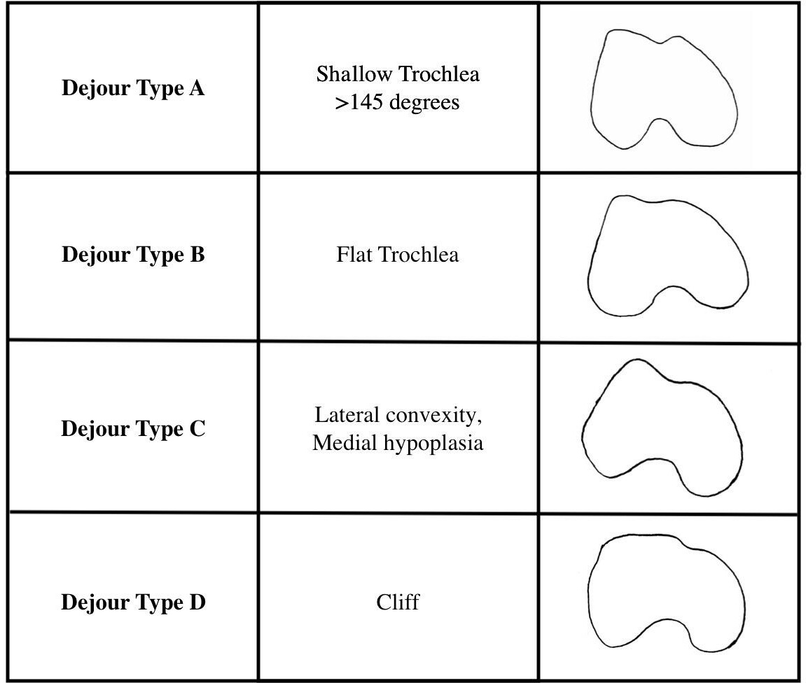 Fig. 2 
          Representation of Dejour Classification.7
        