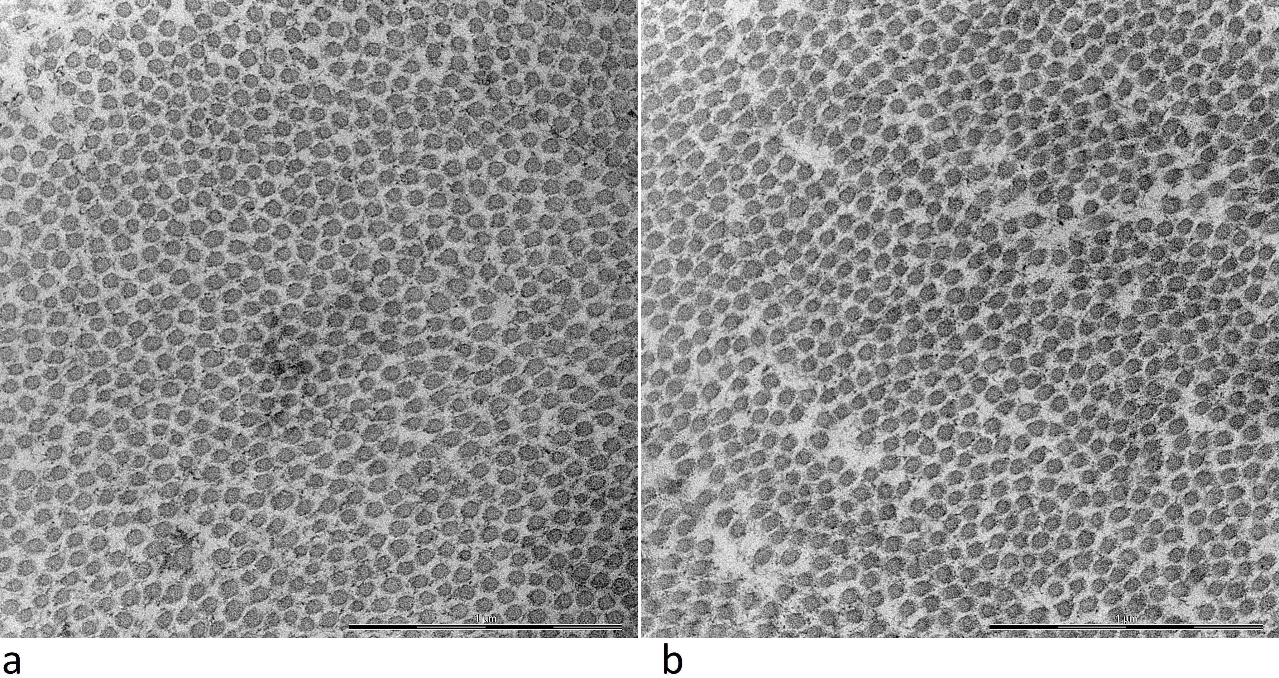 Fig. 1 
          a) Tendon from a standard revision due to loosening eight years postoperatively in a 73-year-old female patient. b) Tendon from an infected 52-year-old male patient with an infection duration of one year. The images appear to have similar fibril diameter distribution, with slightly more ECM between the fibrils in the infected image to the right. Scale bars 1 µm.
        